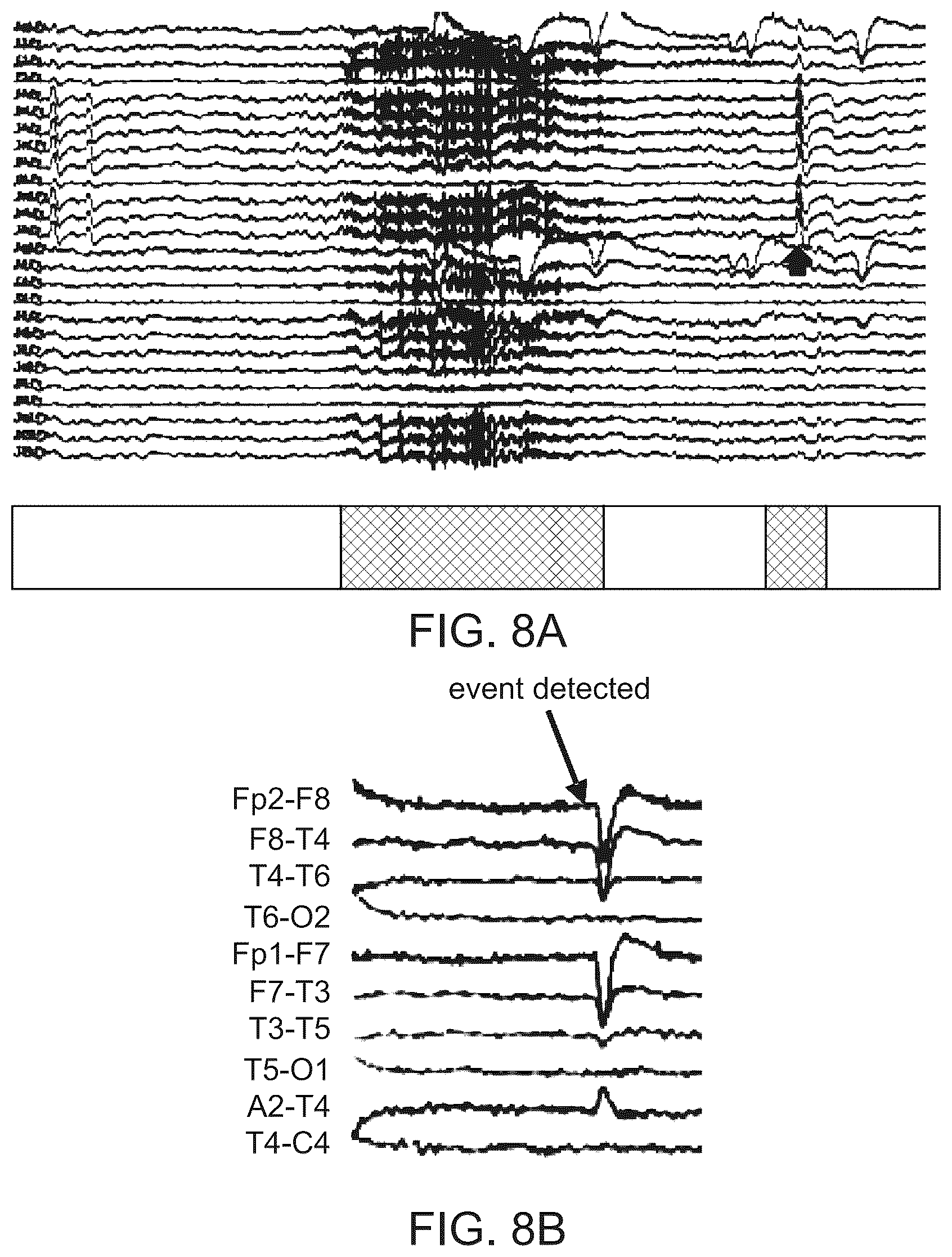 Patent US12455625 Figure 13 – Brain-computer interface with high-speed eye tracking features
