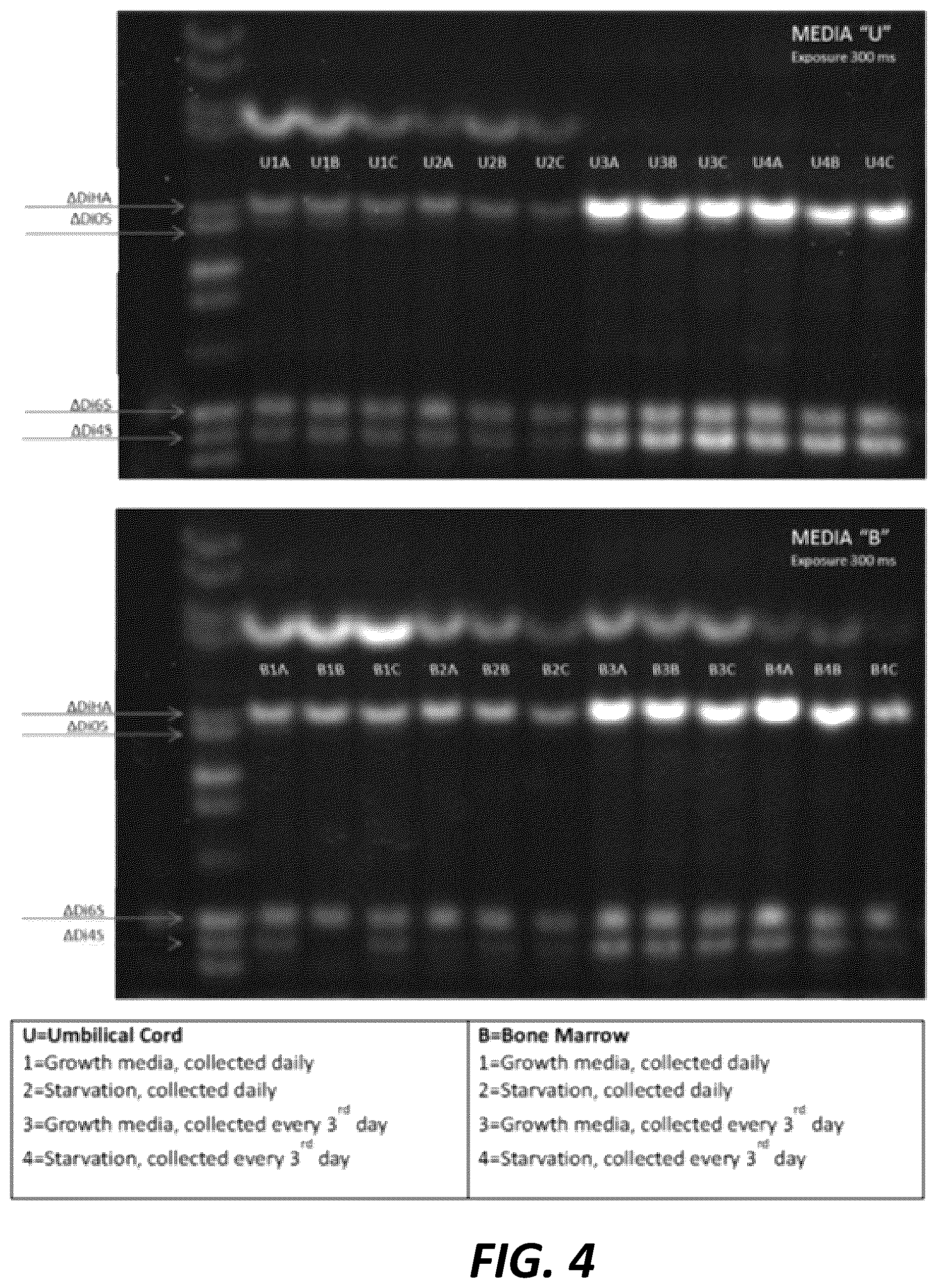 Patent US12460179 Figure 4 – Lyophilized compositions containing umbilical cord lining stem cells conditioned medium