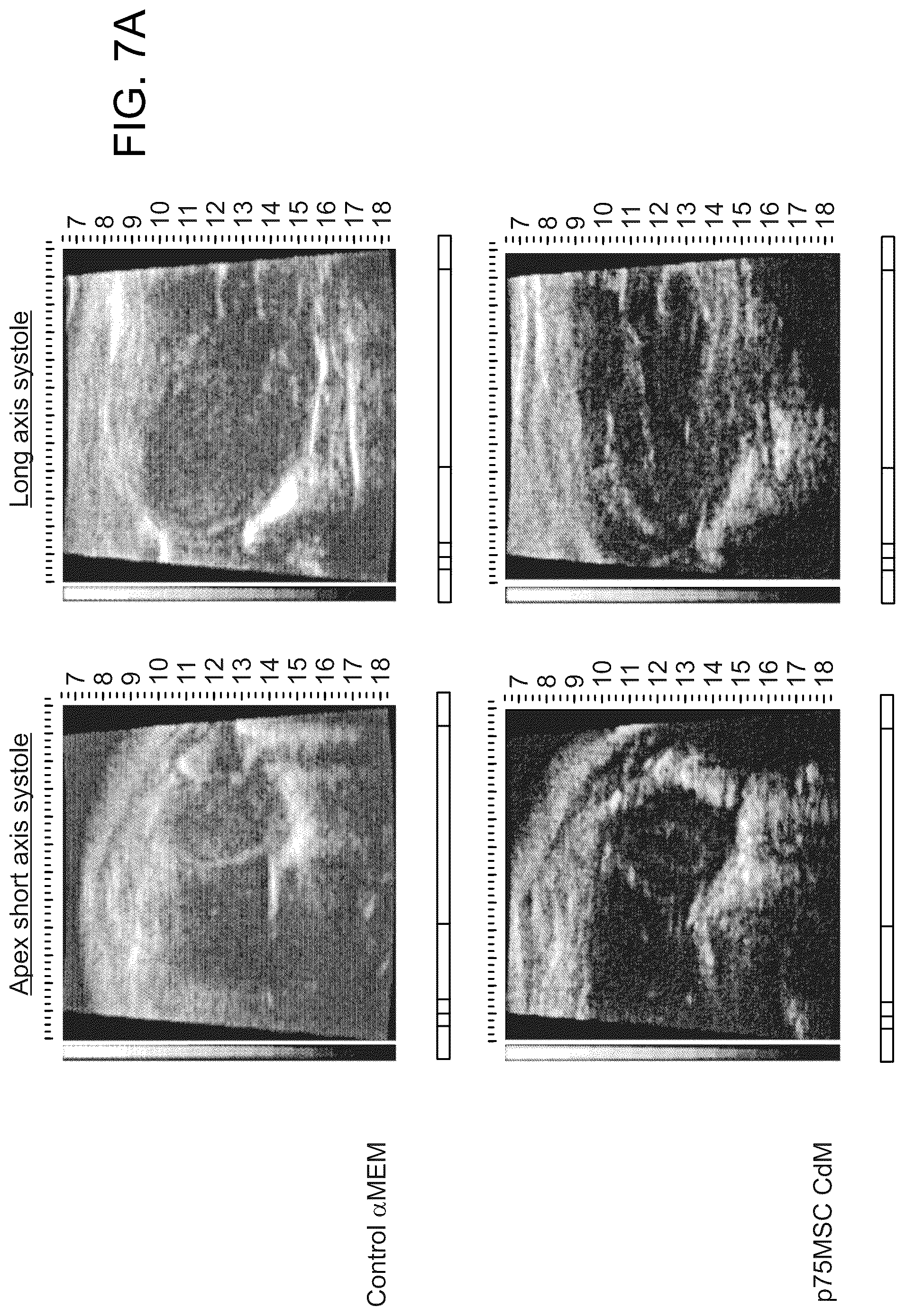 Patent US12460184 Figure 10 – Cell primed with CTGF-D4 and insulin or IGF-1 and use in methods for cardiac tissue repair