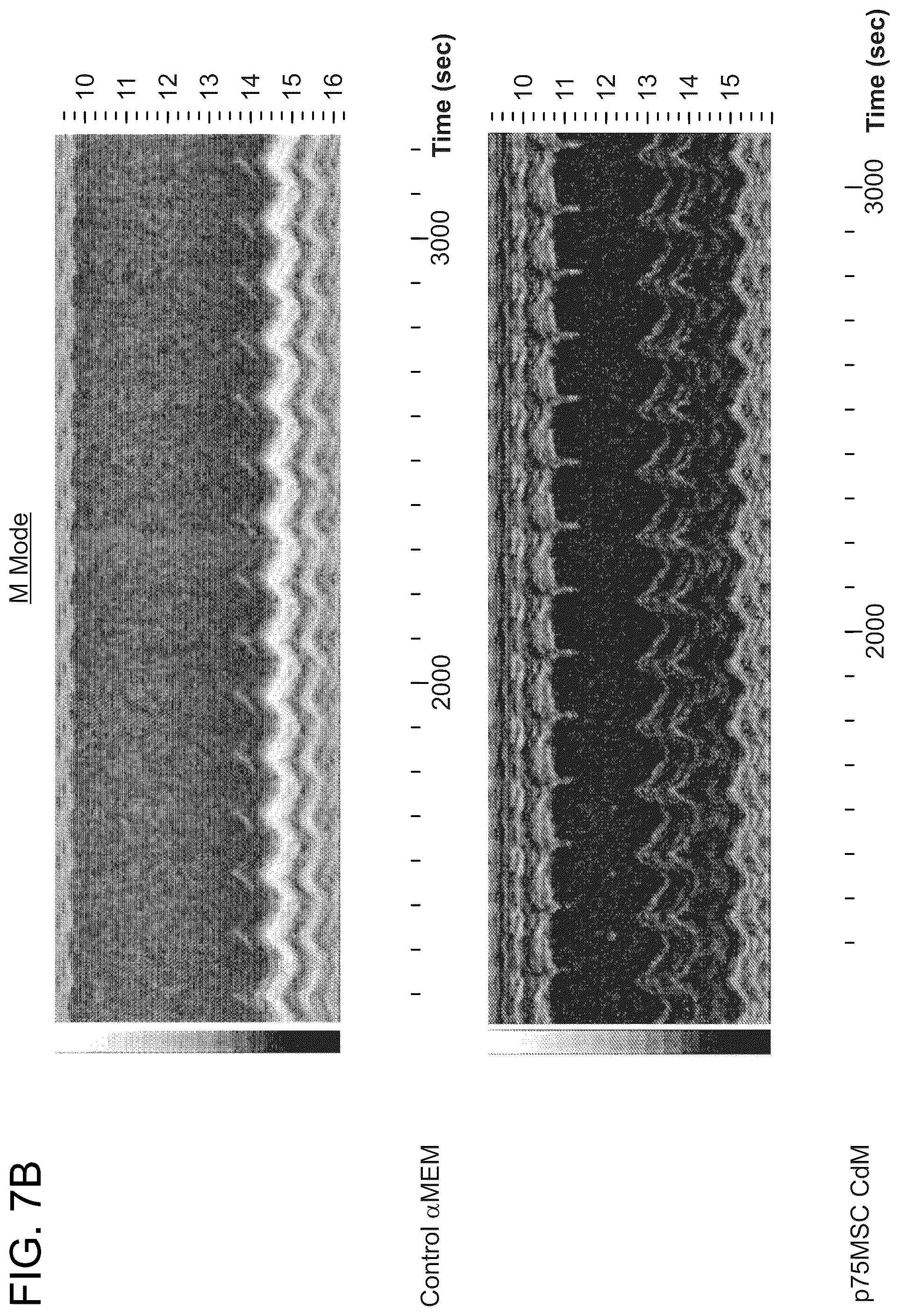 Patent US12460184 Figure 11 – Cell primed with CTGF-D4 and insulin or IGF-1 and use in methods for cardiac tissue repair