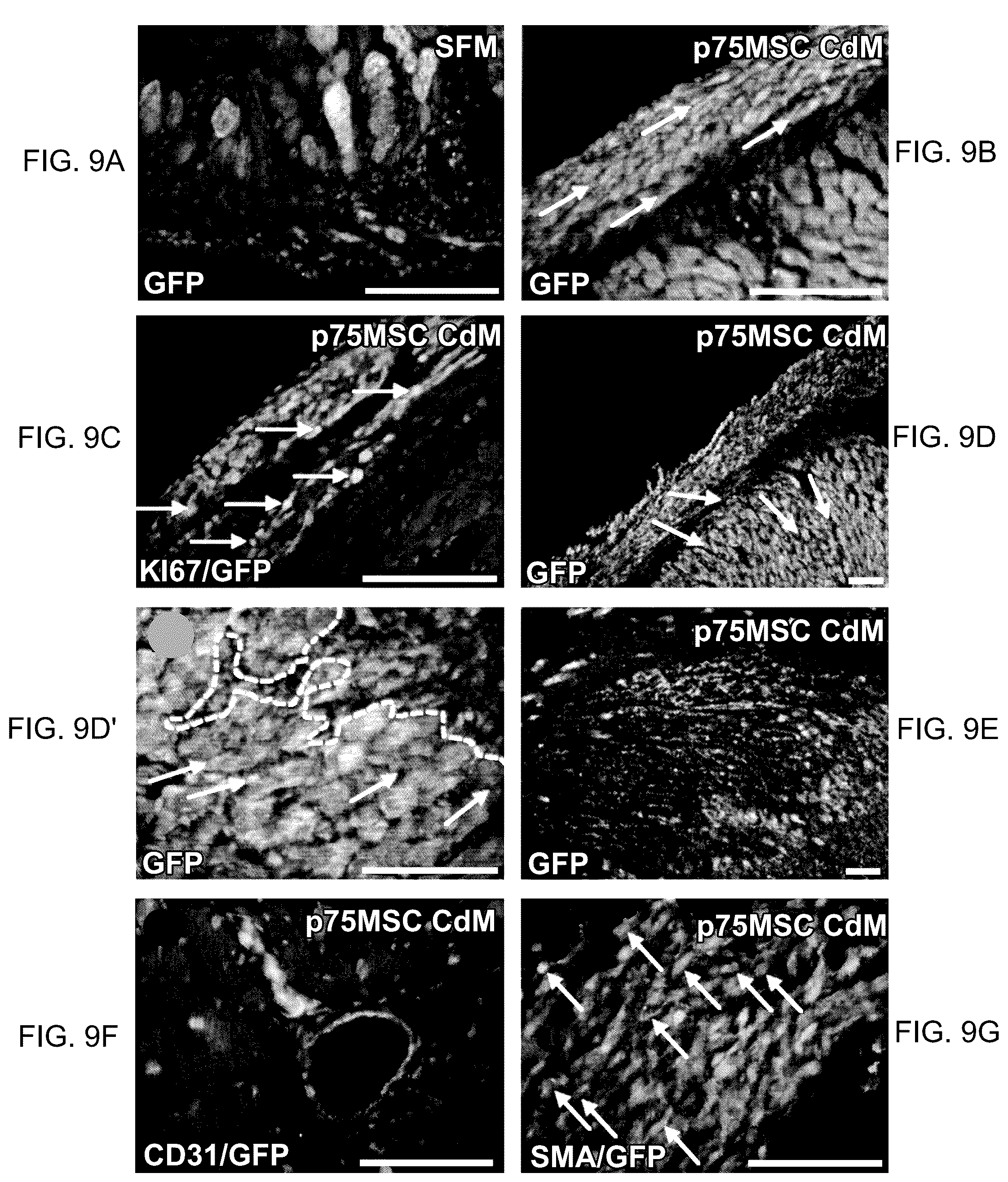 Patent US12460184 Figure 14 – Cell primed with CTGF-D4 and insulin or IGF-1 and use in methods for cardiac tissue repair