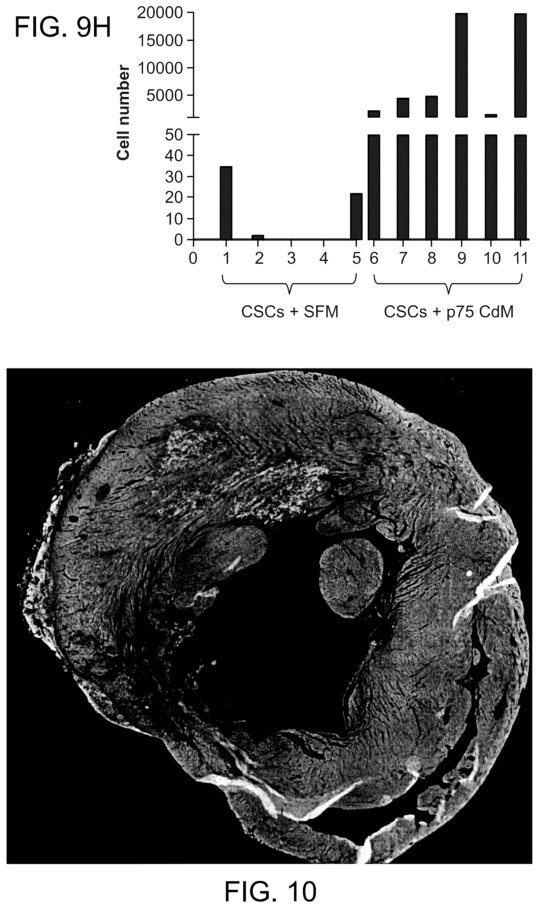 Patent US12460184 Figure 15 – Cell primed with CTGF-D4 and insulin or IGF-1 and use in methods for cardiac tissue repair