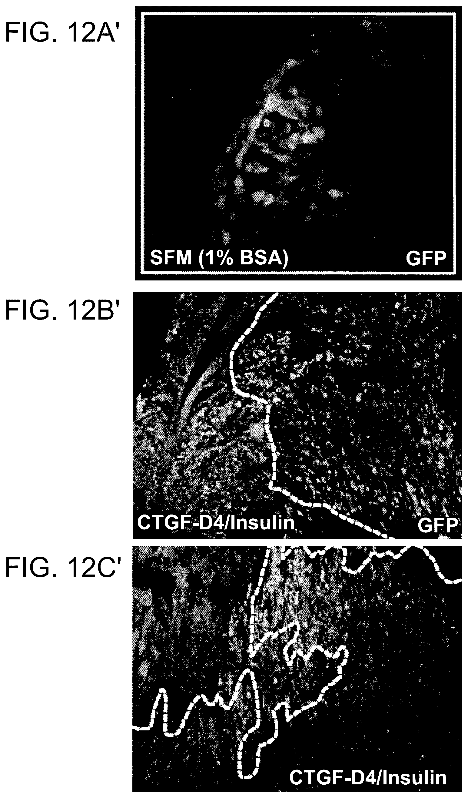 Patent US12460184 Figure 19 – Cell primed with CTGF-D4 and insulin or IGF-1 and use in methods for cardiac tissue repair