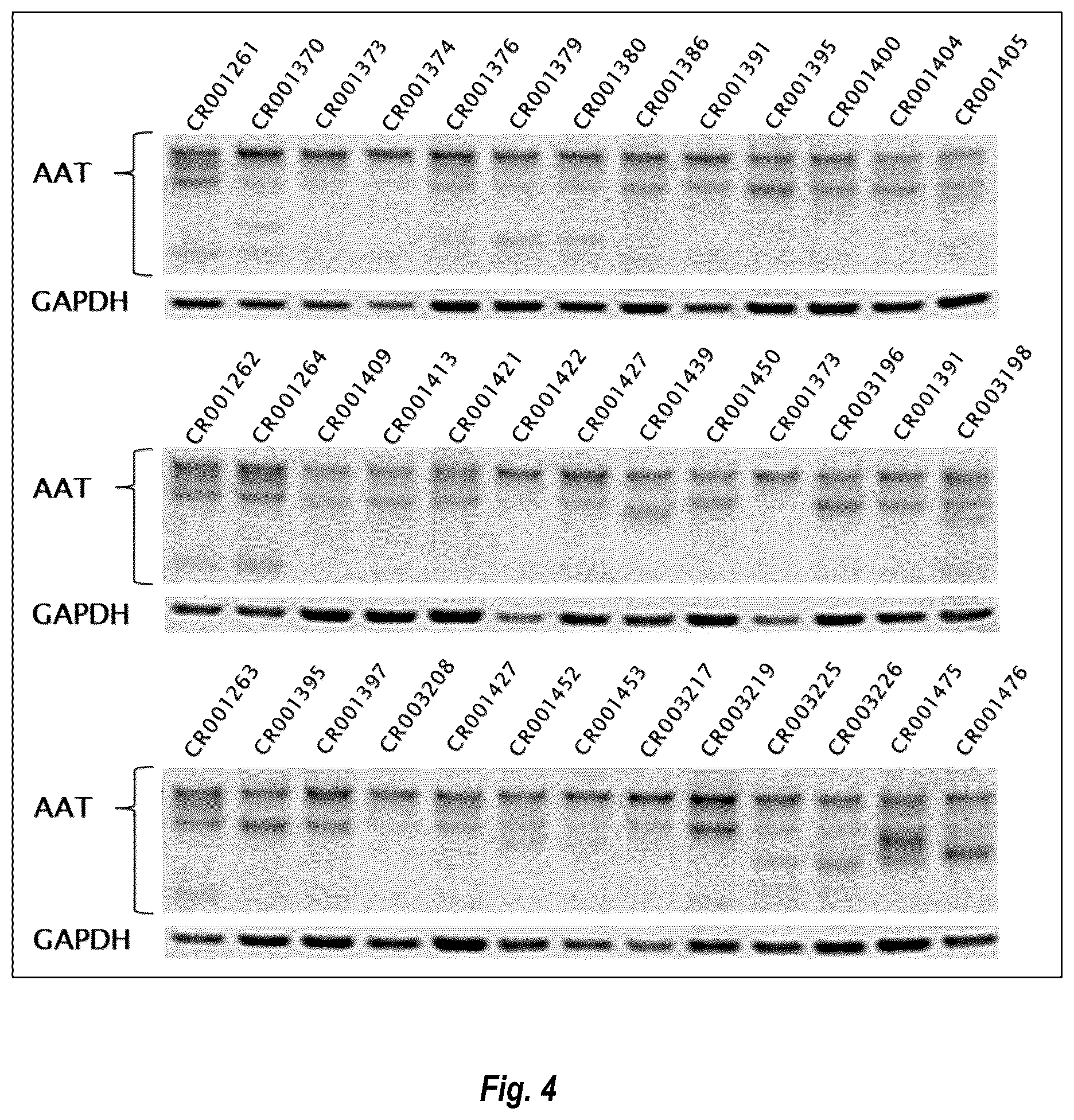 Patent US12460205 Figure 4 – Compositions and methods for treating alpha-1 antitrypsin deficiency
