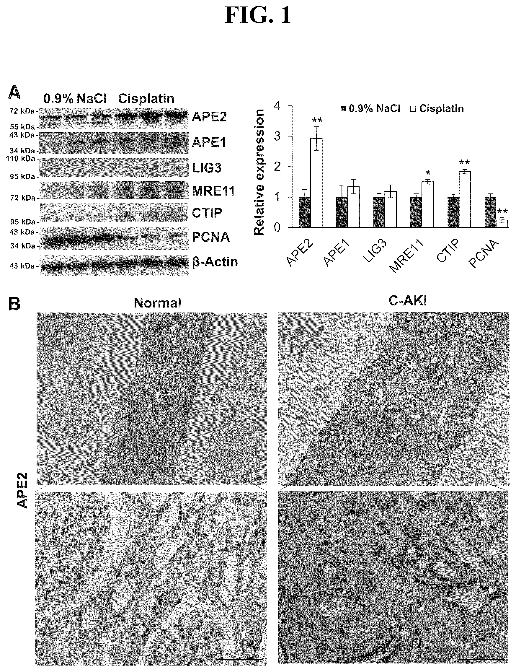 Patent US12460207 Figure 1 – Inhibiting APE2 expression in a subject treated with a drug agent that causes increased APE2 expression