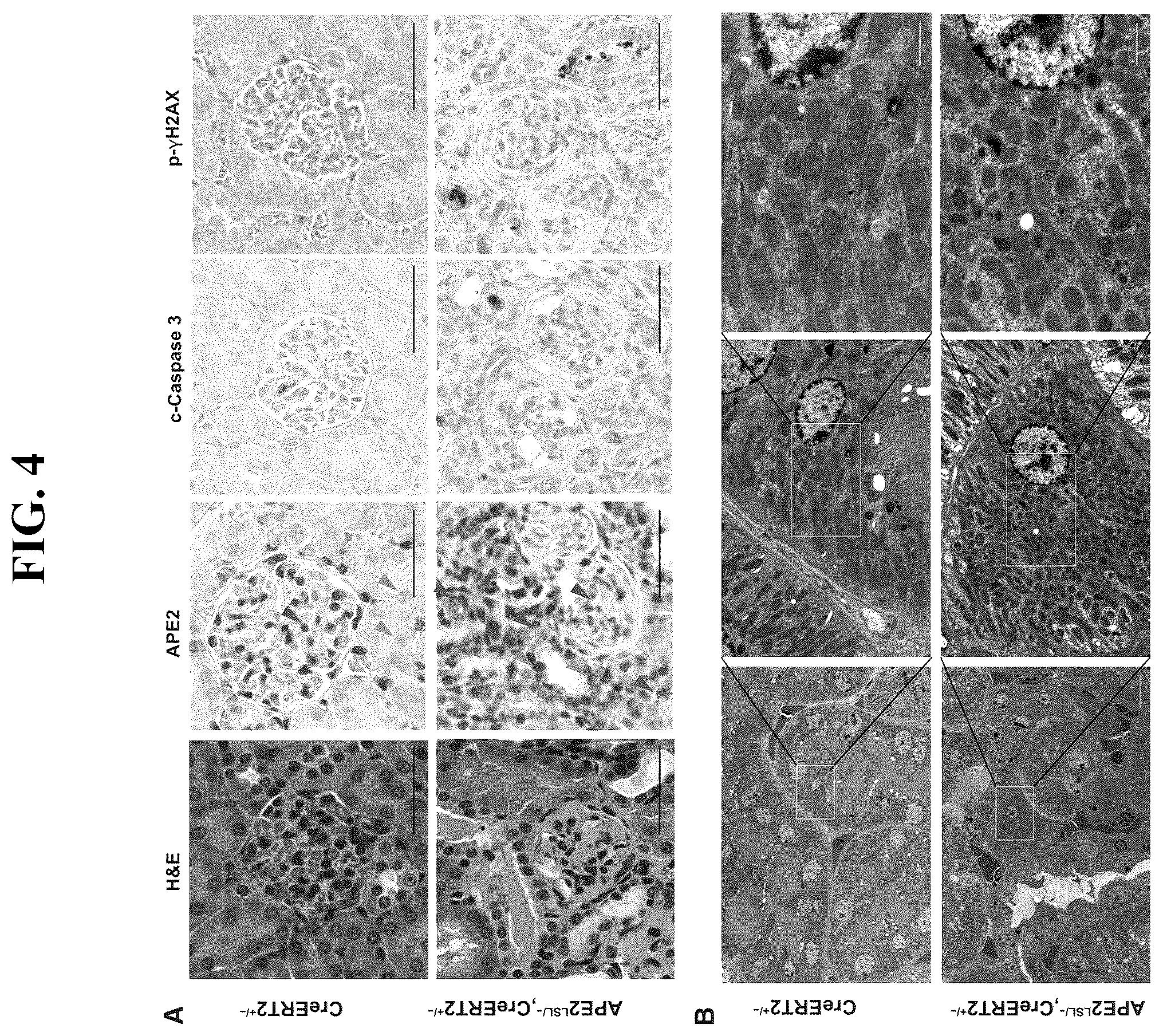 Patent US12460207 Figure 4 – Inhibiting APE2 expression in a subject treated with a drug agent that causes increased APE2 expression