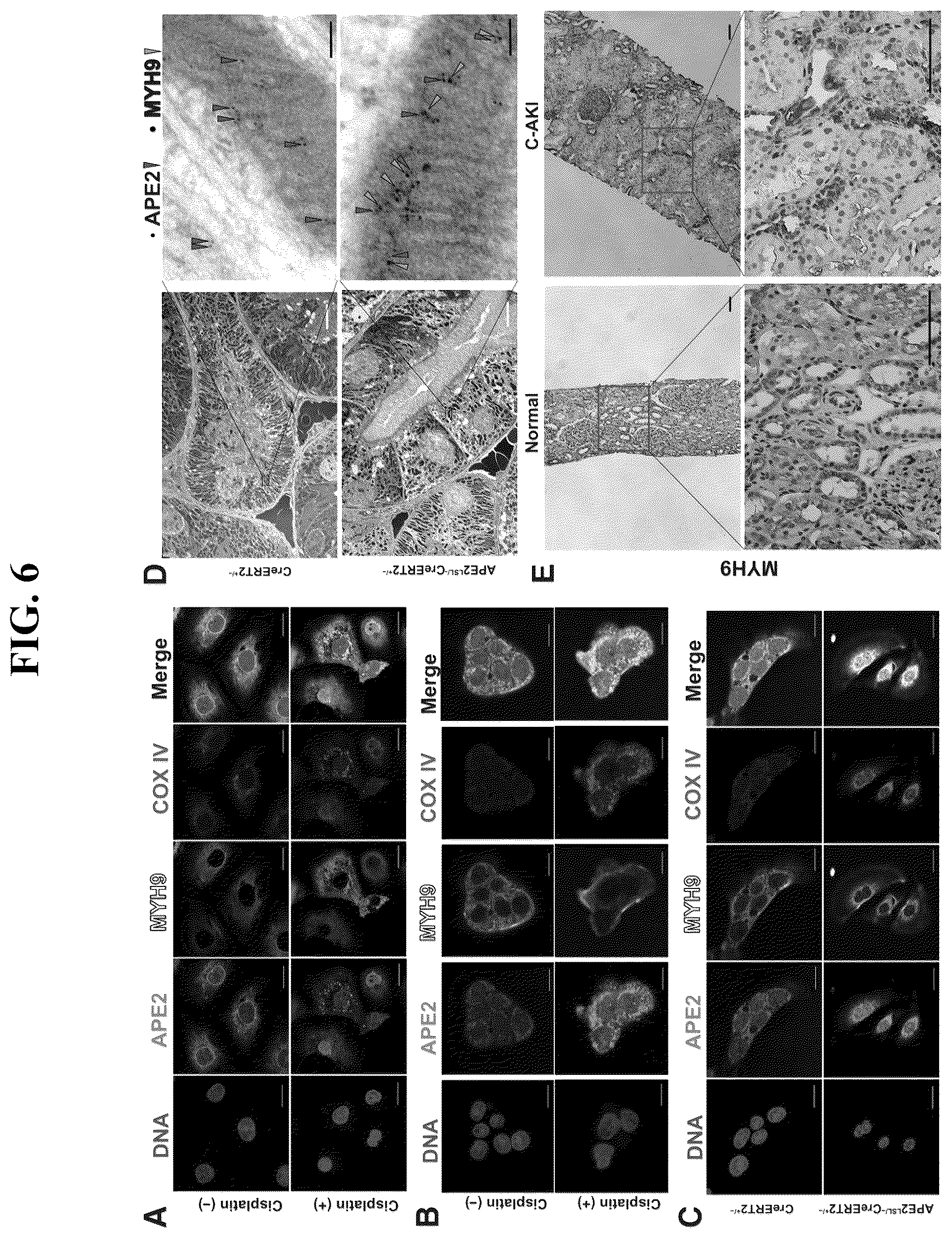 Patent US12460207 Figure 6 – Inhibiting APE2 expression in a subject treated with a drug agent that causes increased APE2 expression