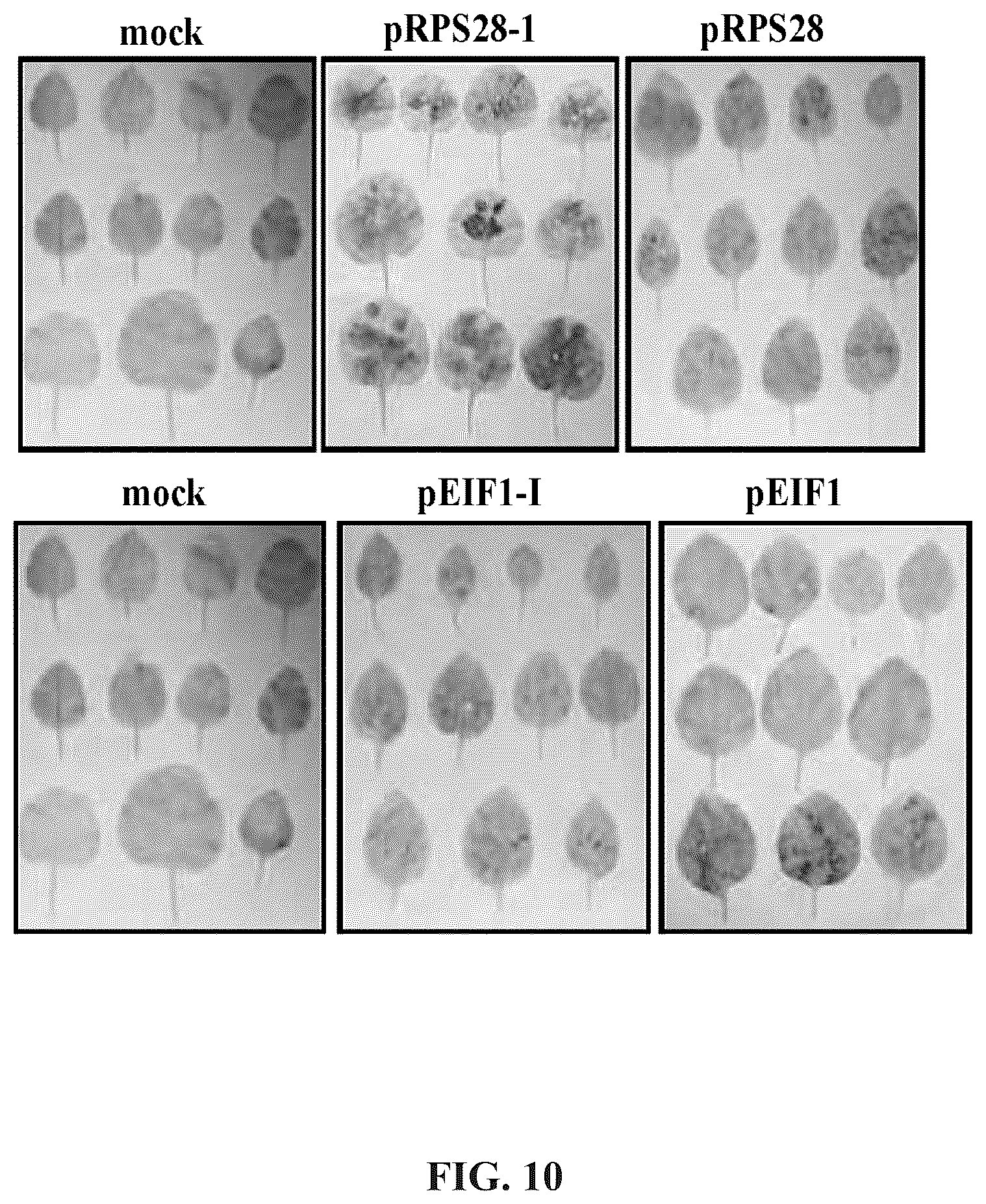 Patent US12460220 Figure 20 – Method for promoting expression of foreign gene in soybean, arabidopsis or tobacco using gene promoter pEIF1 or pEIF1-I