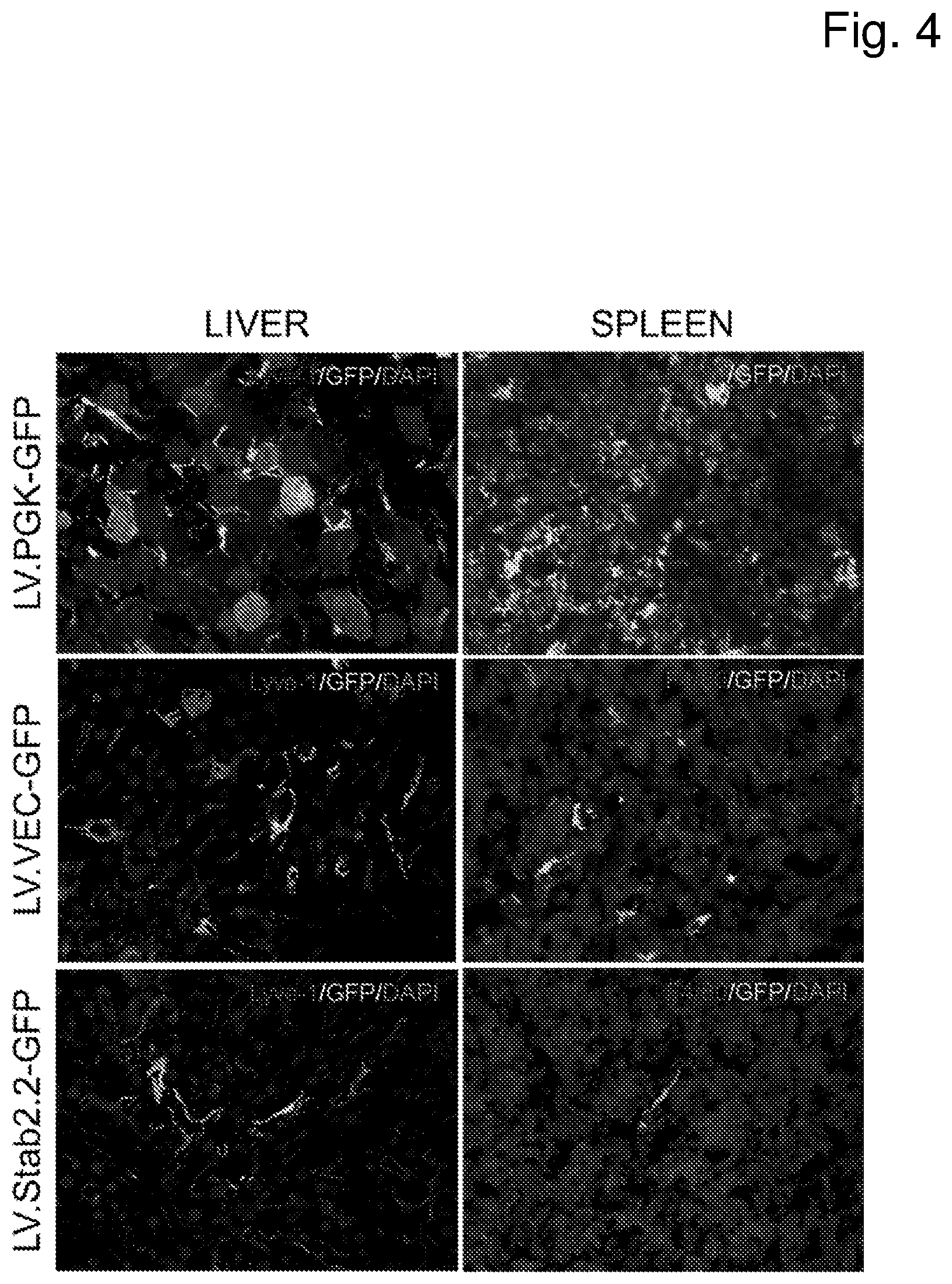 Patent US12460225 Figure 4 – Vector with an endothelial-specific promoter for treating factor V, VII, VIII, or IX deficiency