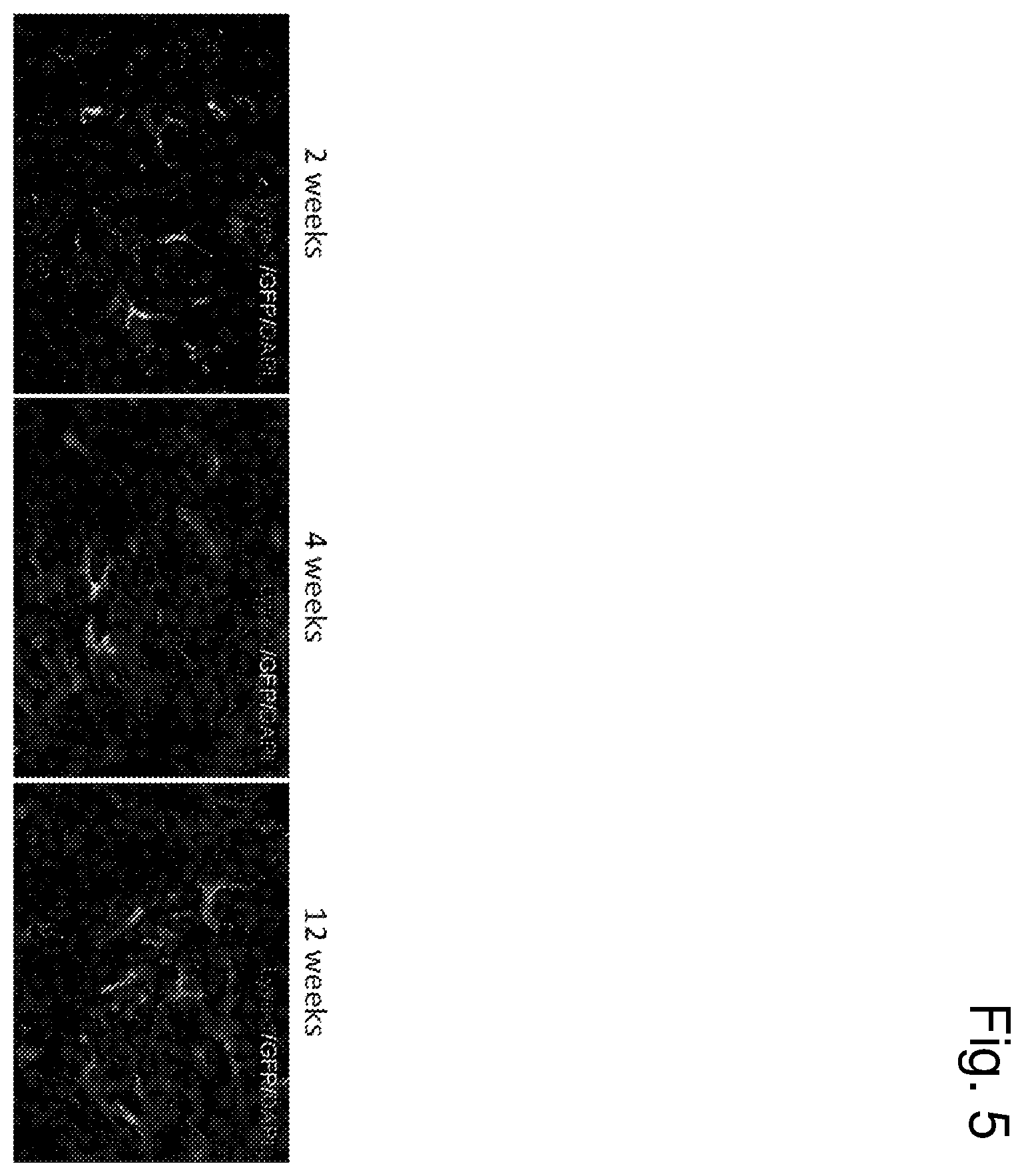 Patent US12460225 Figure 5 – Vector with an endothelial-specific promoter for treating factor V, VII, VIII, or IX deficiency