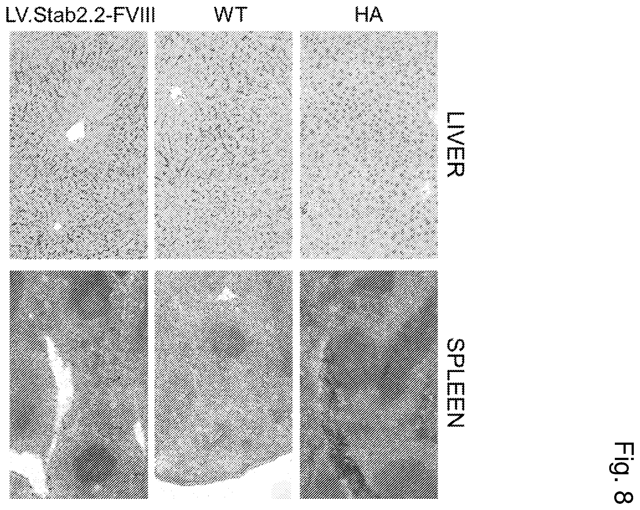 Patent US12460225 Figure 8 – Vector with an endothelial-specific promoter for treating factor V, VII, VIII, or IX deficiency