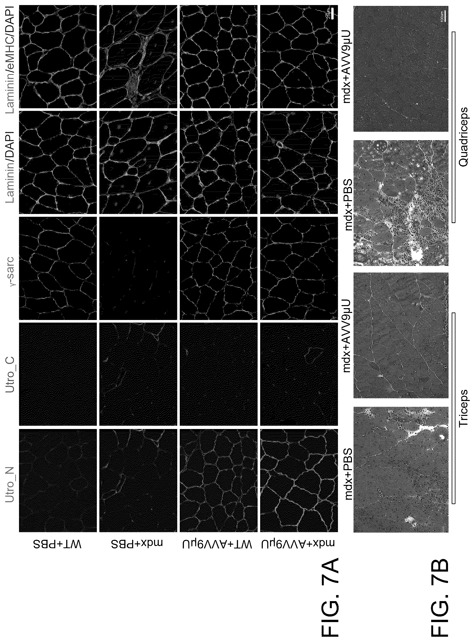 Patent US12460226 Figure 10 – Compositions and methods for treating duchenne muscular dystrophy