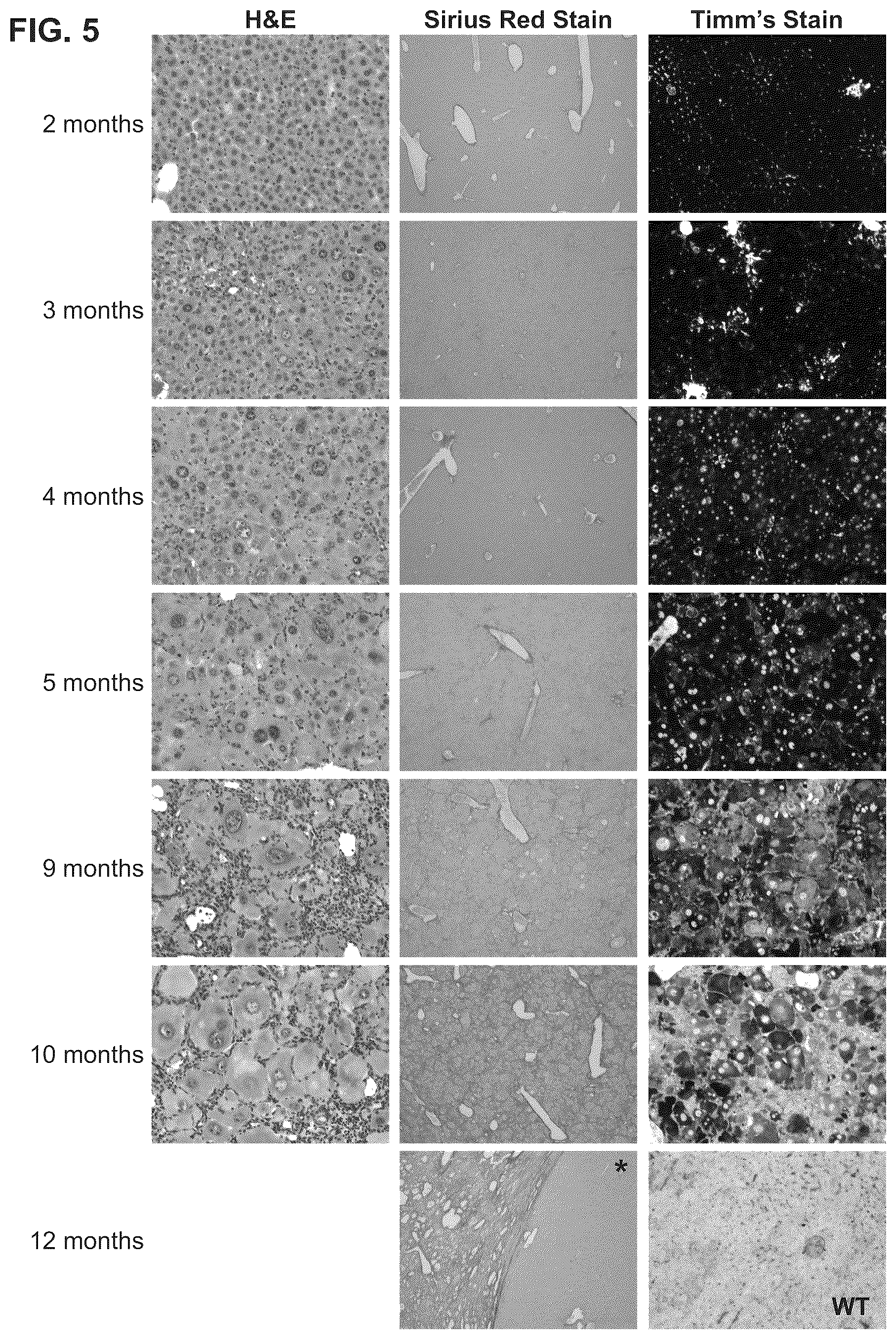 Patent US12460228 Figure 5 – Gene therapy for treating Wilson's disease