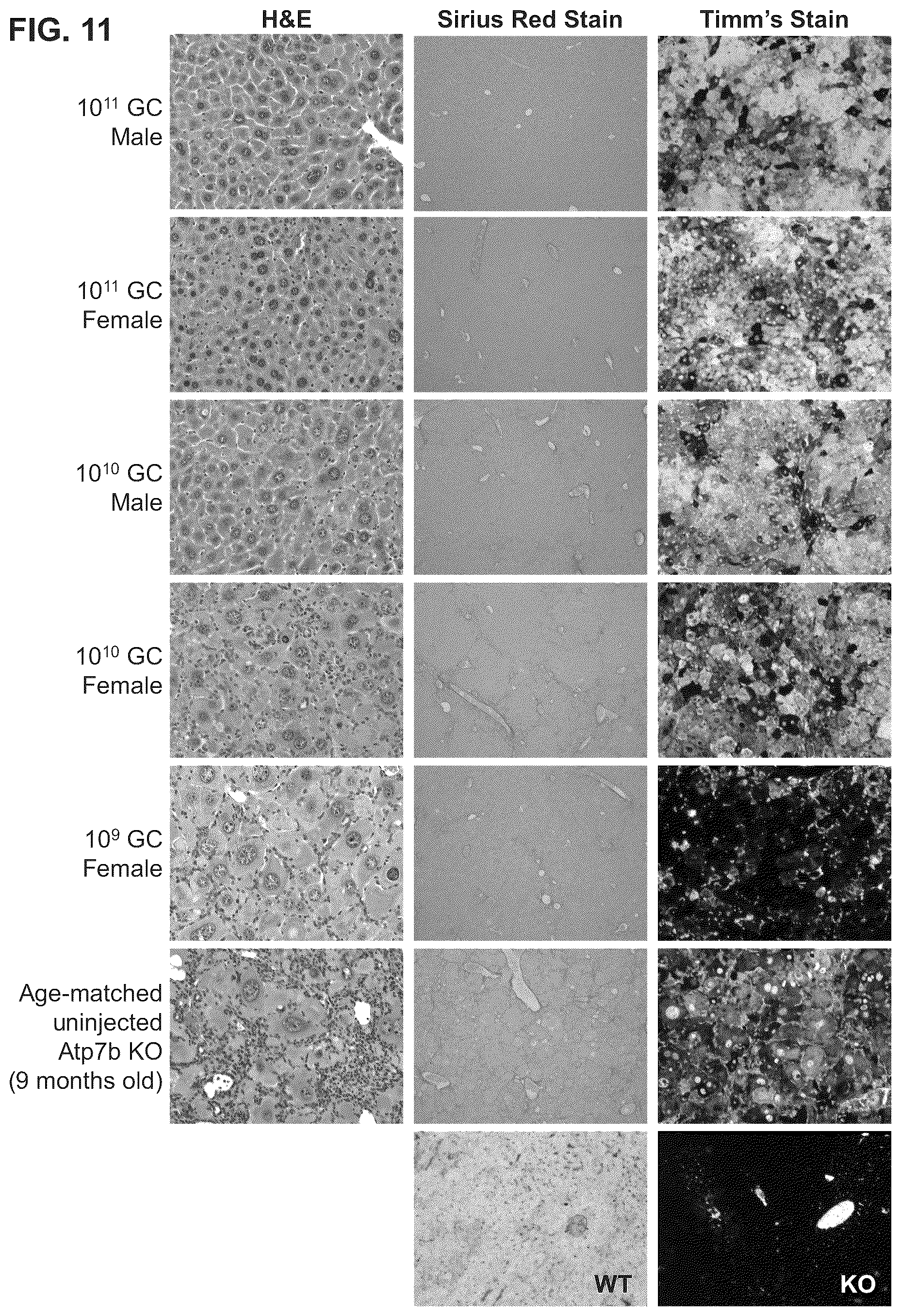 Patent US12460228 Figure 11 – Gene therapy for treating Wilson's disease