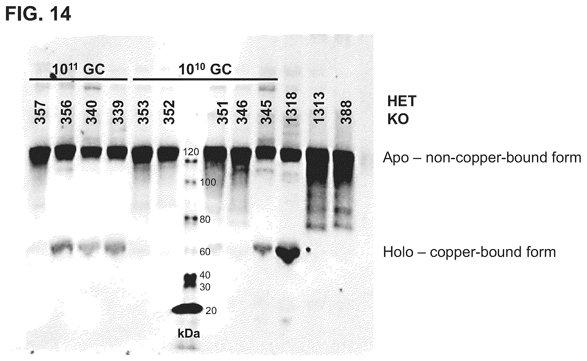 Patent US12460228 Figure 14 – Gene therapy for treating Wilson's disease