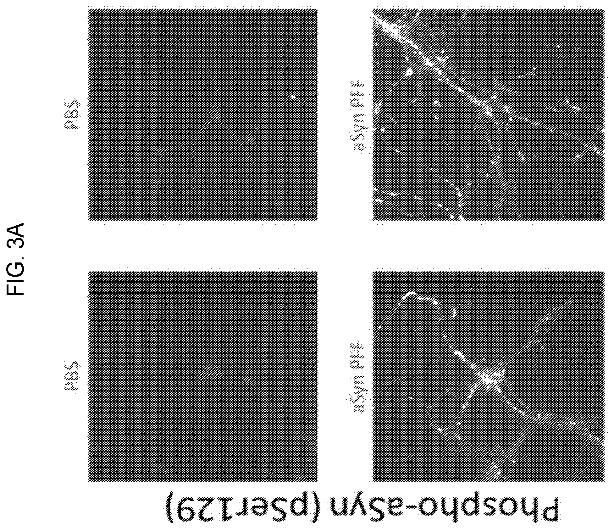 Patent US12460262 Figure 5 – Methods of detecting, preventing, reversing, and treating neurological diseases