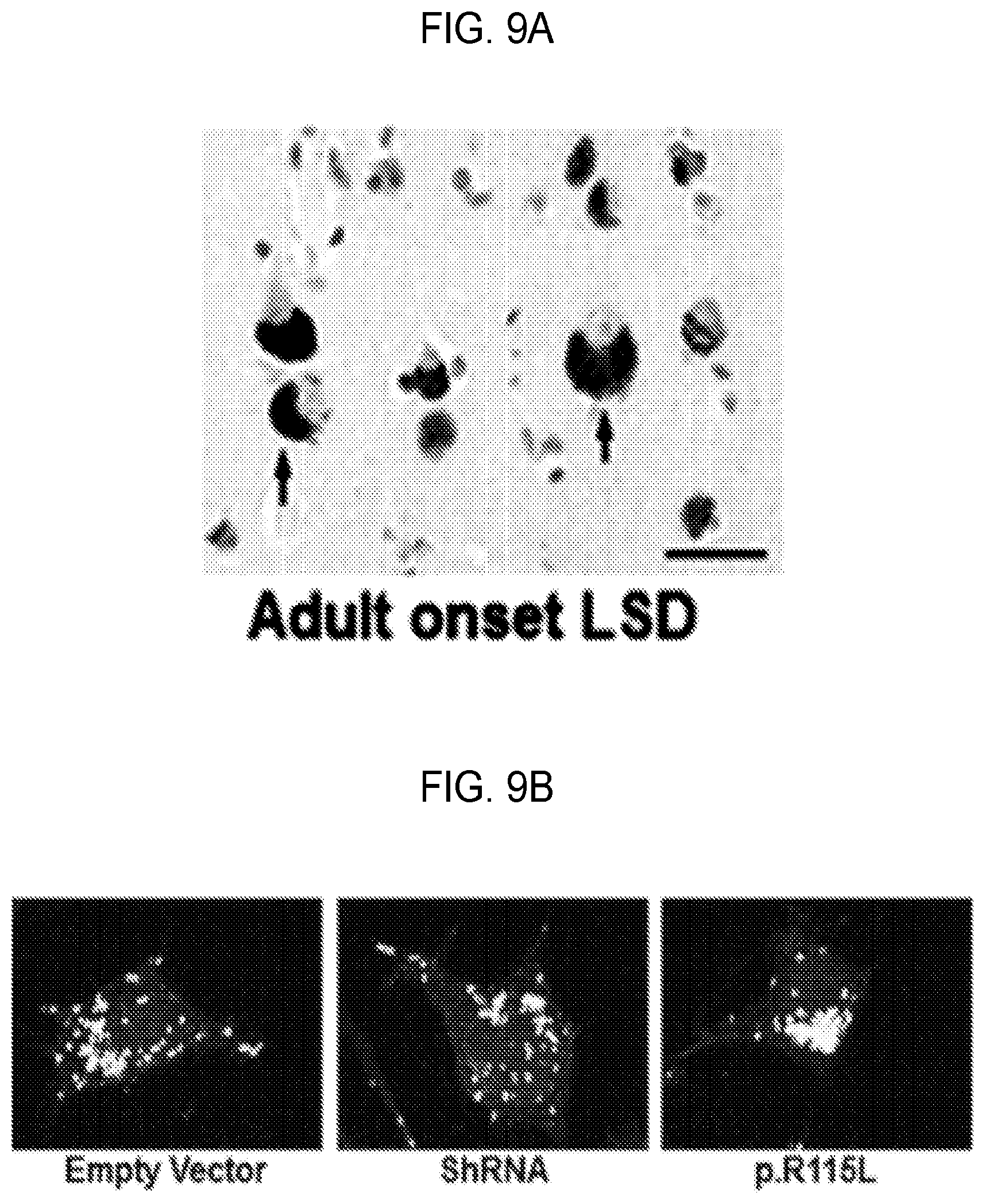 Patent US12460262 Figure 11 – Methods of detecting, preventing, reversing, and treating neurological diseases