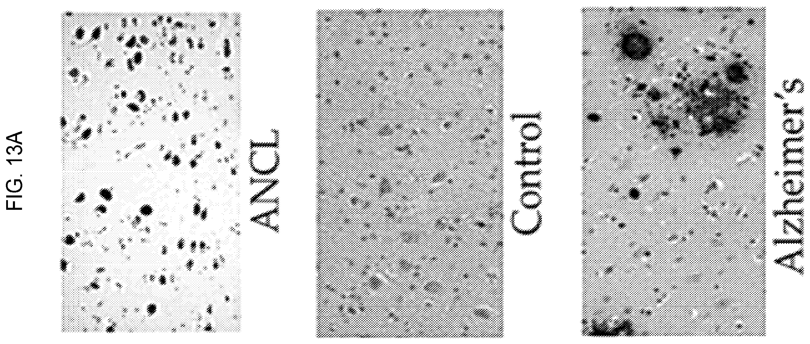 Patent US12460262 Figure 18 – Methods of detecting, preventing, reversing, and treating neurological diseases