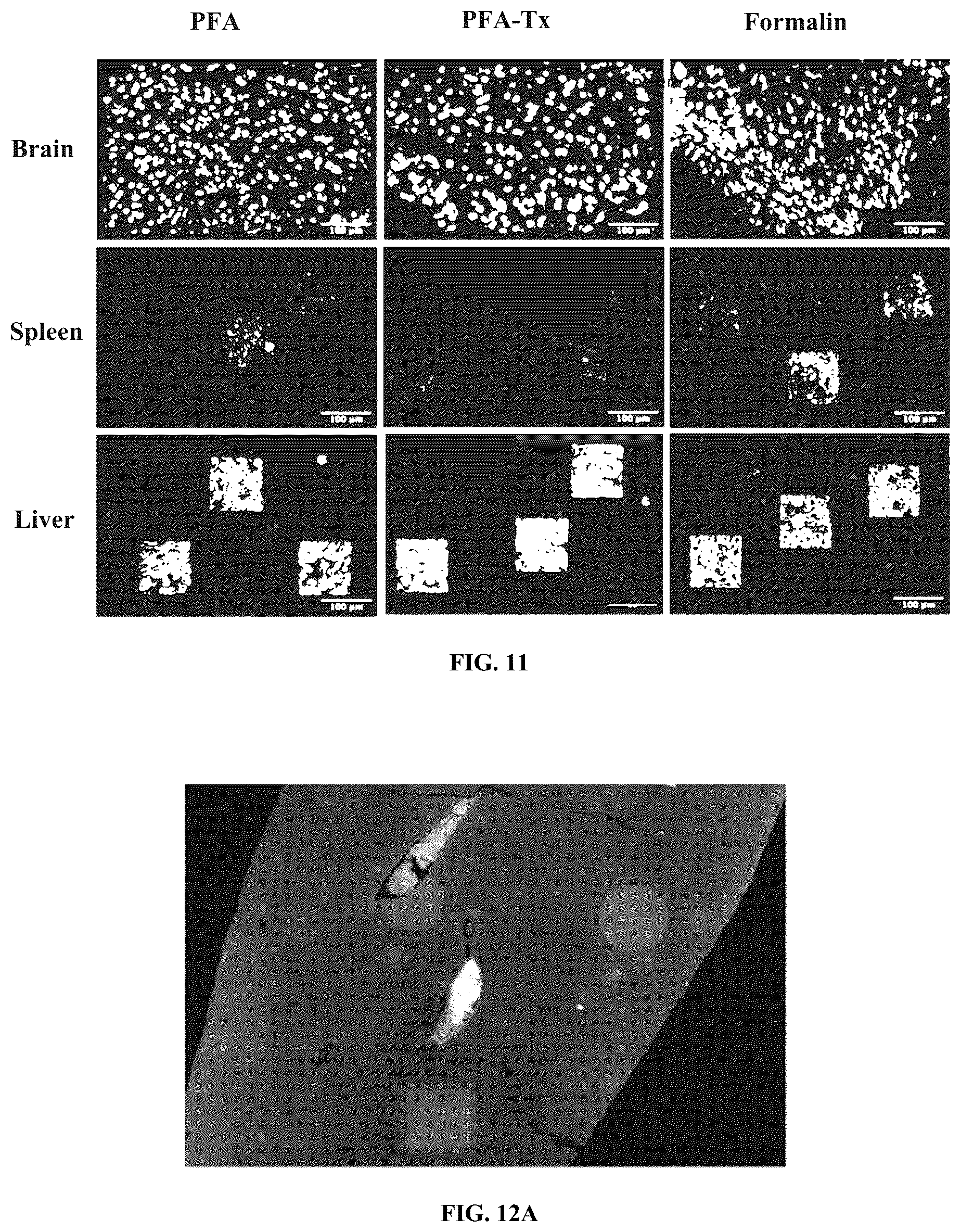 Patent US12460319 Figure 11 – Tissue spatial omics