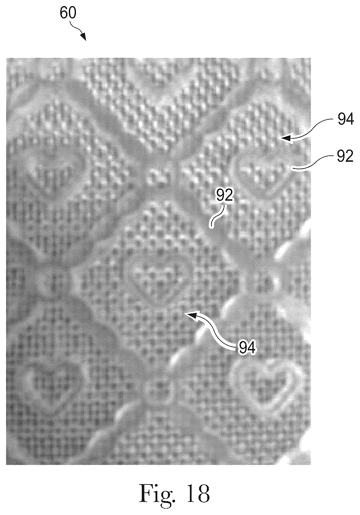 Patent US12460321 Figure 11 – Shaped nonwoven