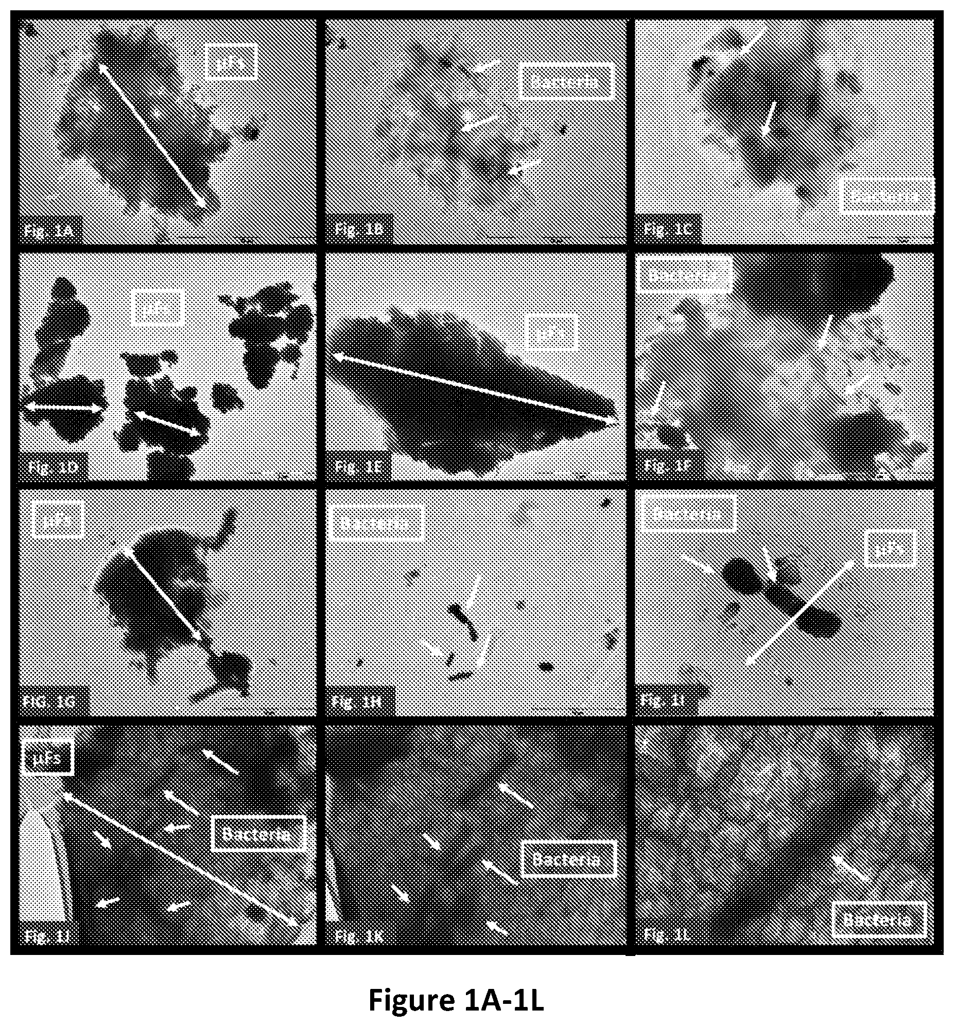 Patent US12460347 Figure 1 – Functional fibrous material comprising microbial flakes, methods of preparing and uses thereof