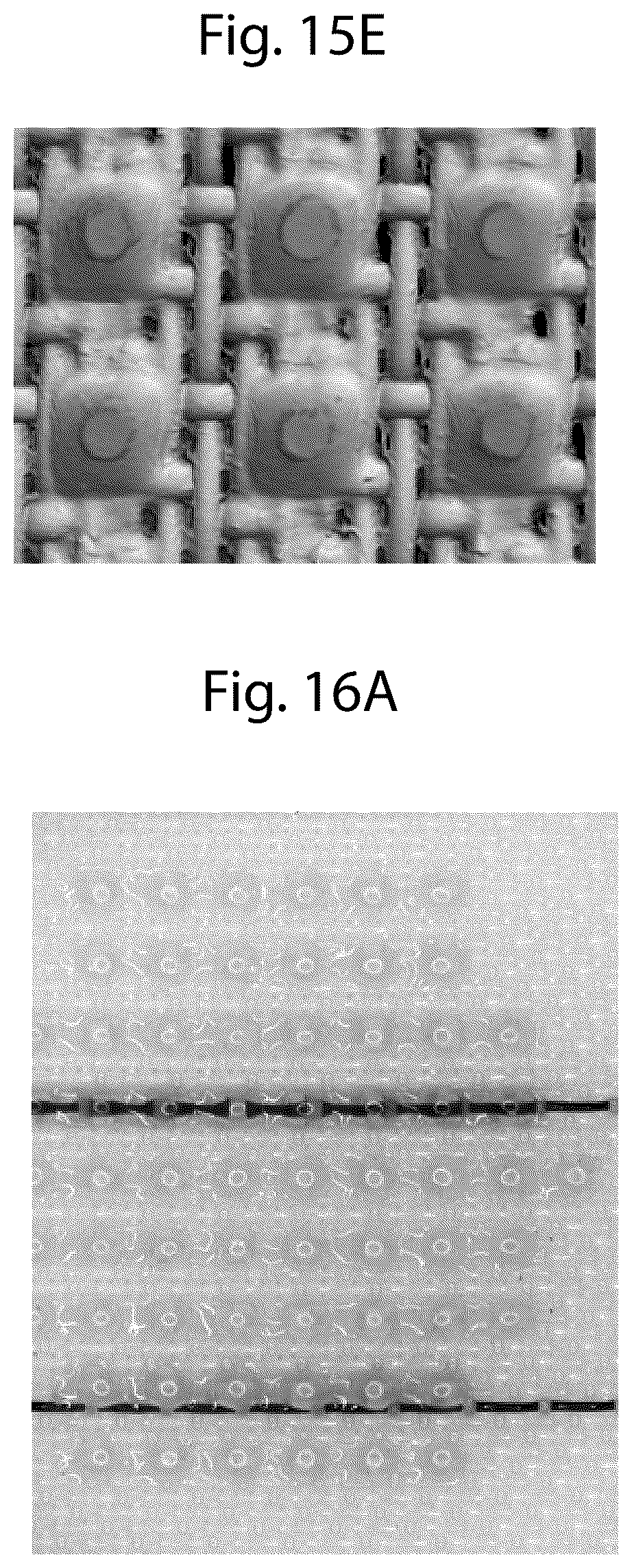 Patent US12460350 Figure 18 – Discretized patterned belt for tissues, towels, and nonwovens