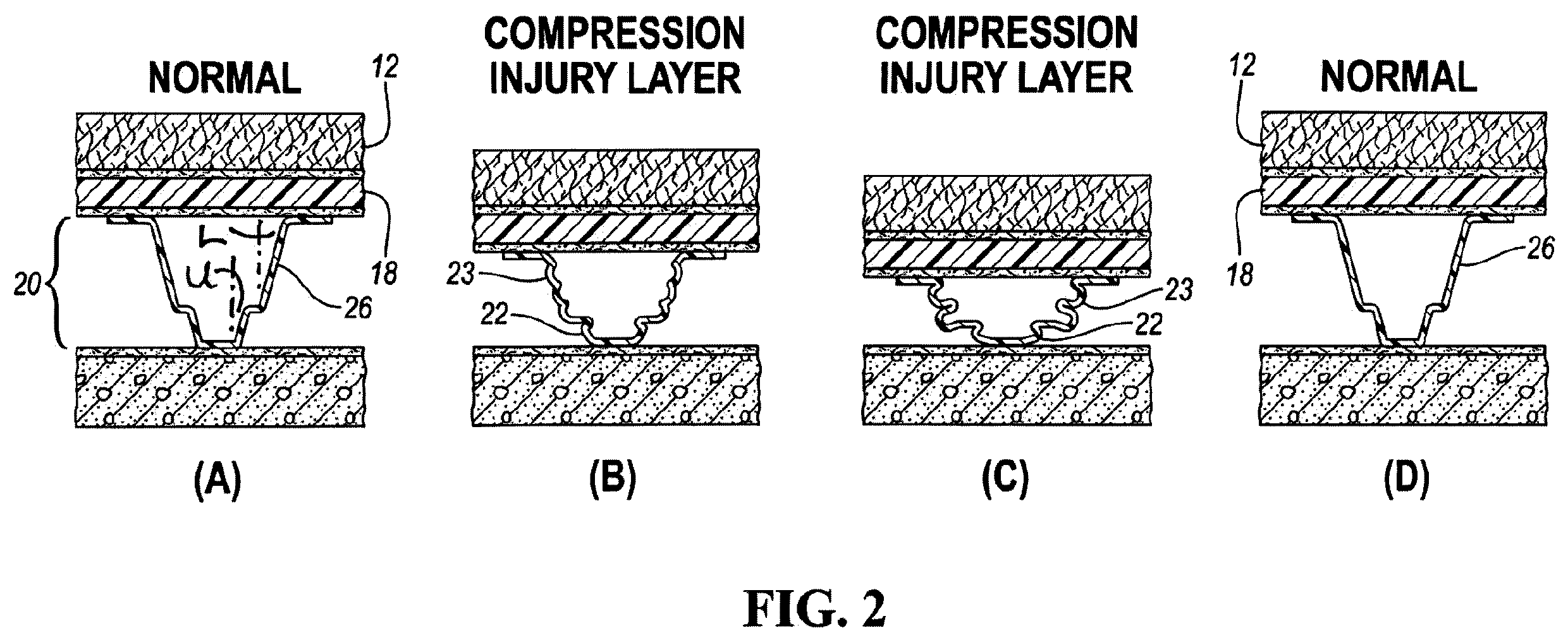 Patent US12460427 Figure 2 – Dual-purpose progressive stage load-distributing and absorbing system