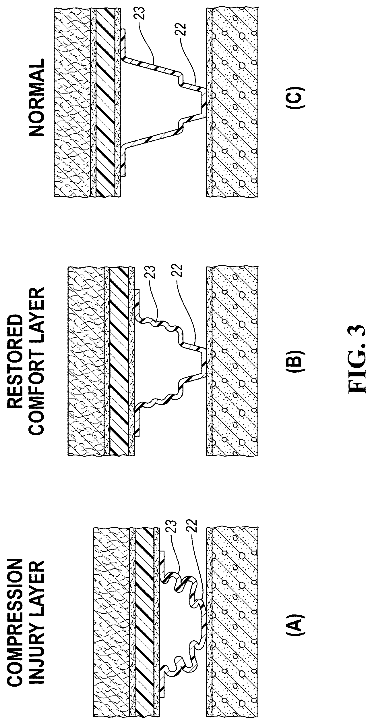 Patent US12460427 Figure 3 – Dual-purpose progressive stage load-distributing and absorbing system