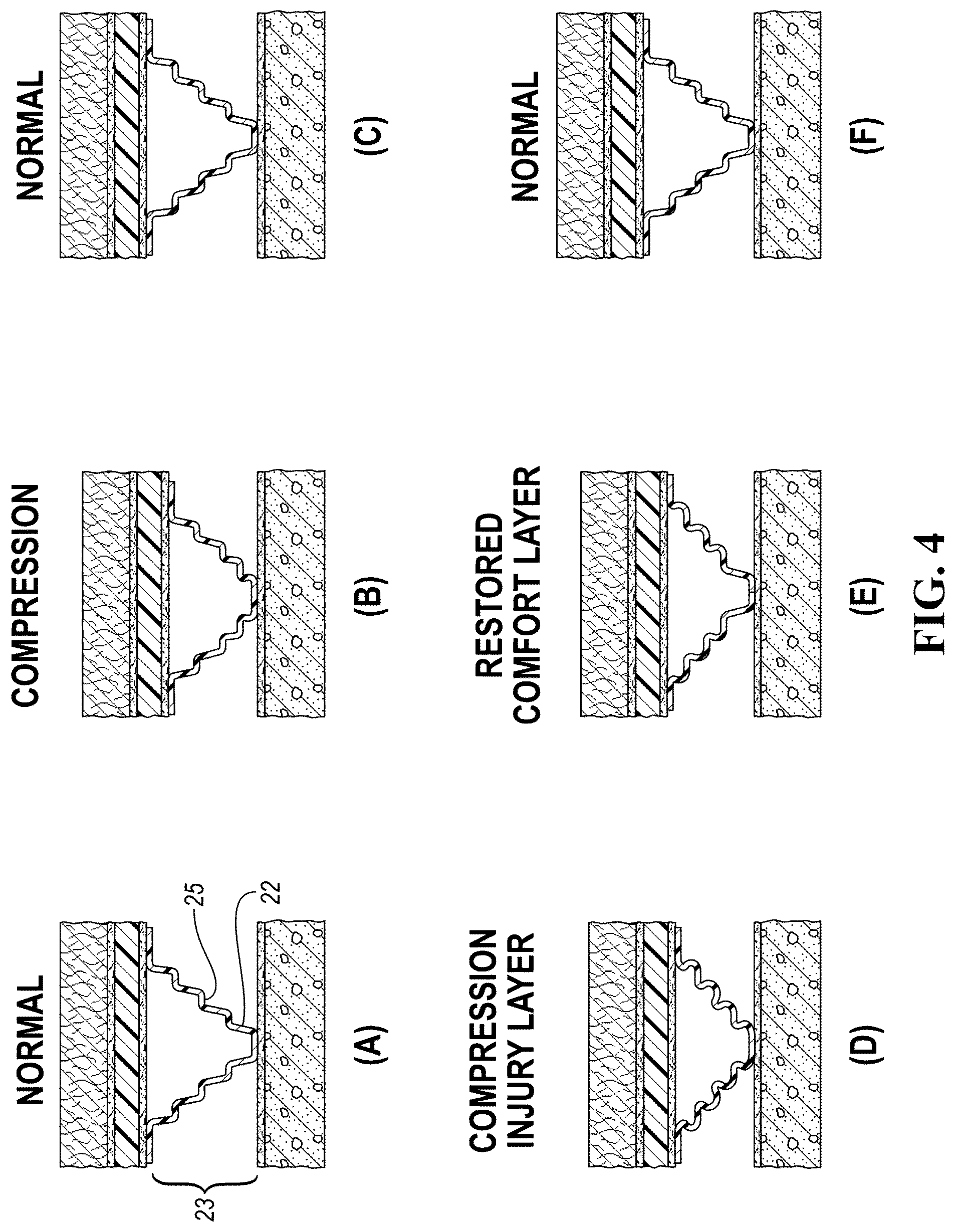 Patent US12460427 Figure 4 – Dual-purpose progressive stage load-distributing and absorbing system