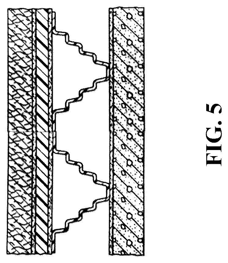 Patent US12460427 Figure 5 – Dual-purpose progressive stage load-distributing and absorbing system