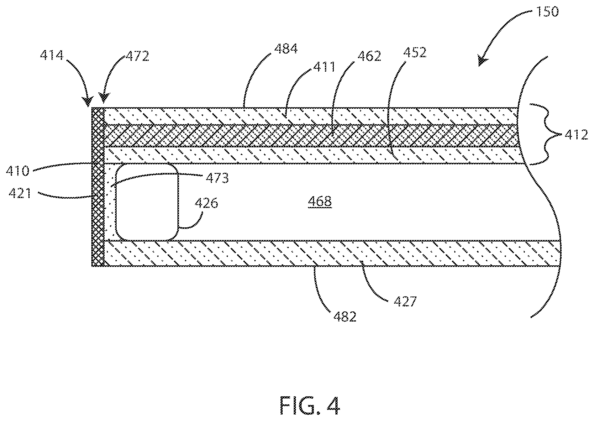 Patent US12460457 Figure 4 – Sash tilt bolt and checkrail bracket systems for coastal impact resistant fenestrations