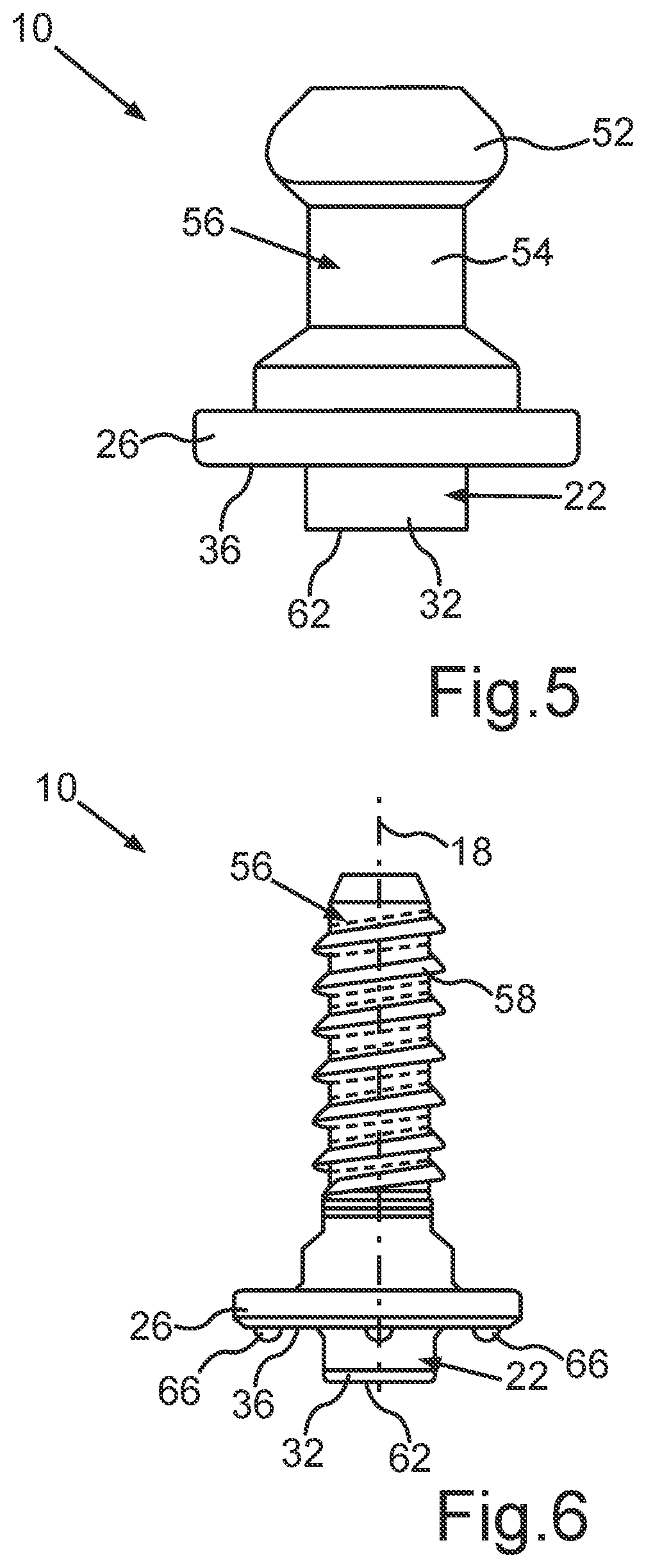 Patent US12460667 Figure 3 – Functional component, component assembly comprising a functional component, and method for securing a functional component to a holding component