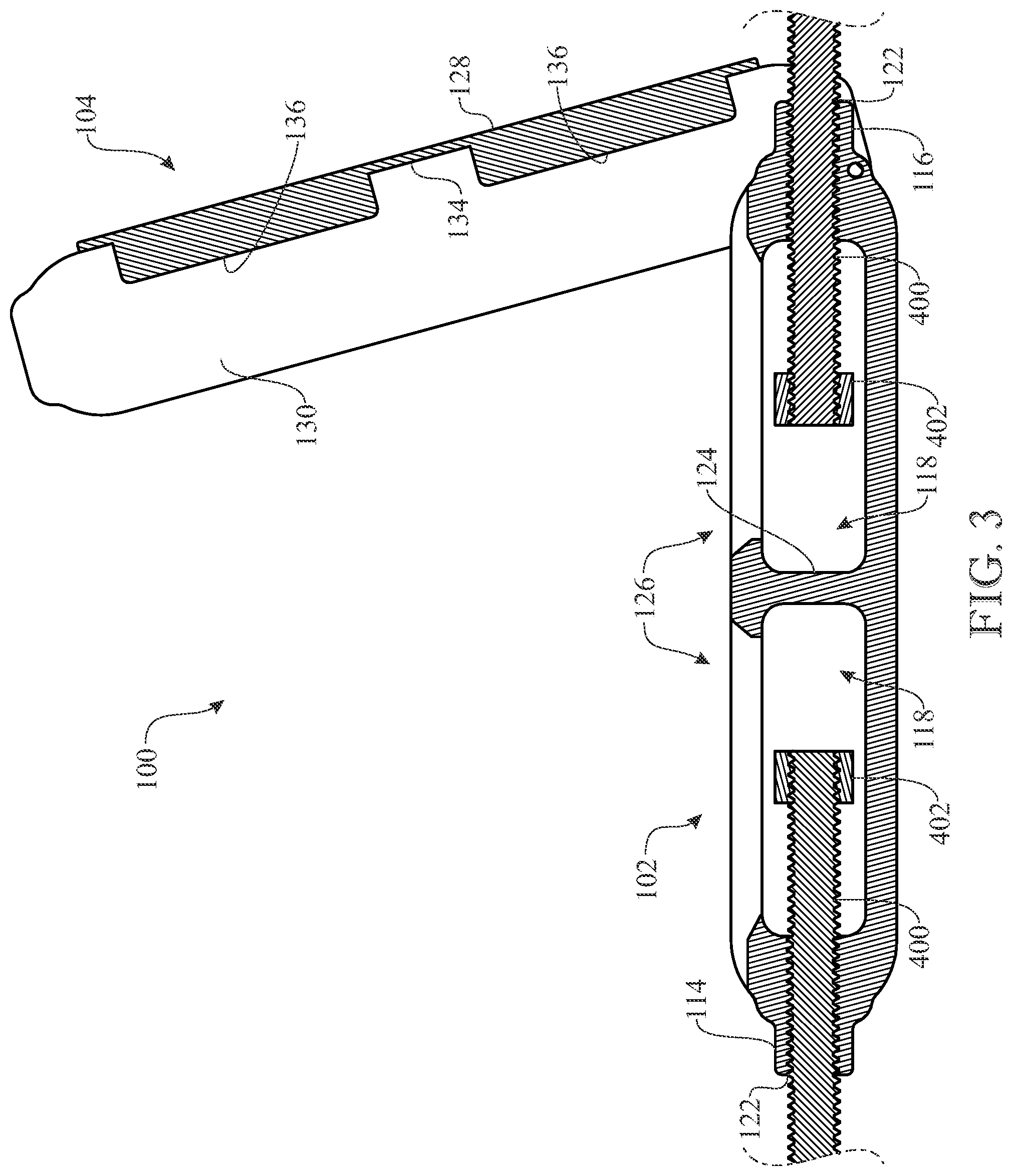 Patent US12460700 Figure 2 – Locking turnbuckle