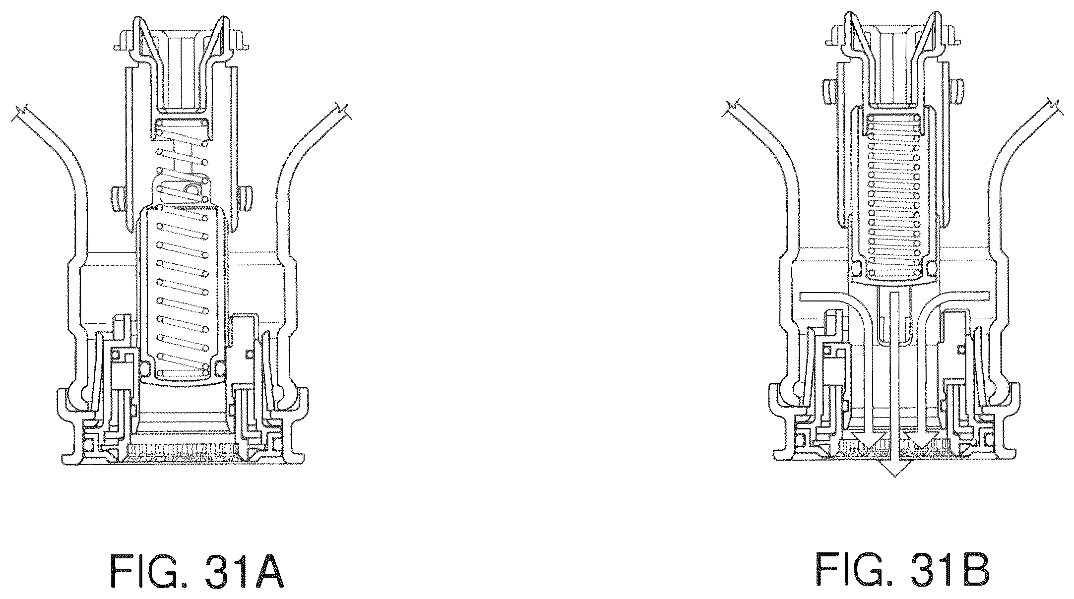 Patent US12460741 Figure 18 – Safety valve for returnable bottle, bottle collar and process for plugging a returnable bottle