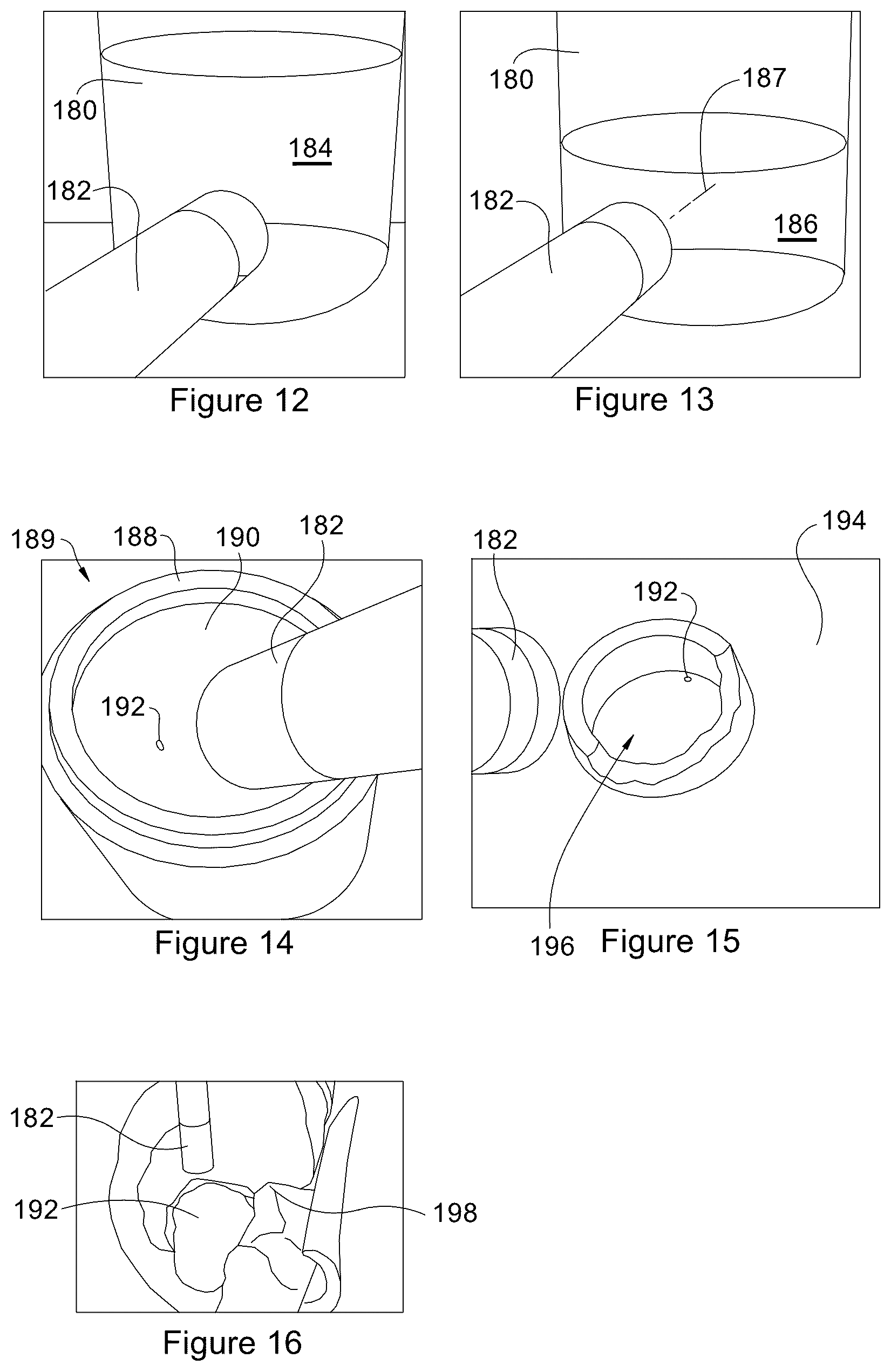 Patent US12460906 Figure 5 – Shaped charge liners with integrated tracers