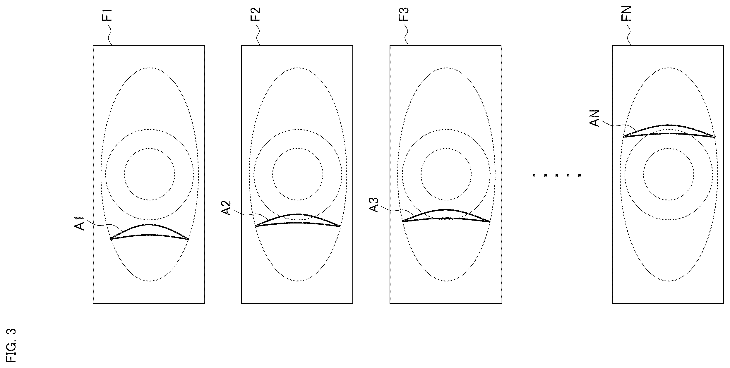 Patent US12468135 Figure 4 – Slit lamp microscope