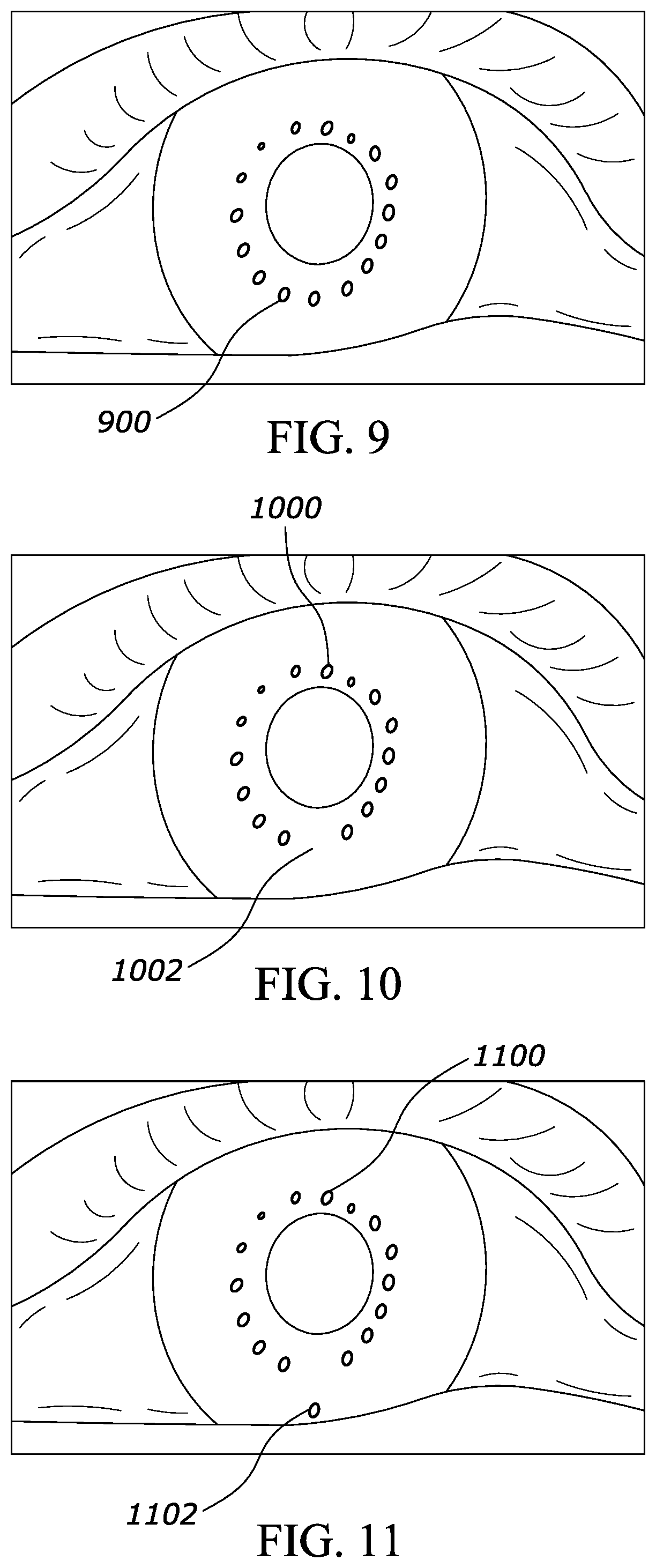 Patent US12468156 Figure 6 – System to detect add-on prescription lenses to VR HMDs with eye tracking