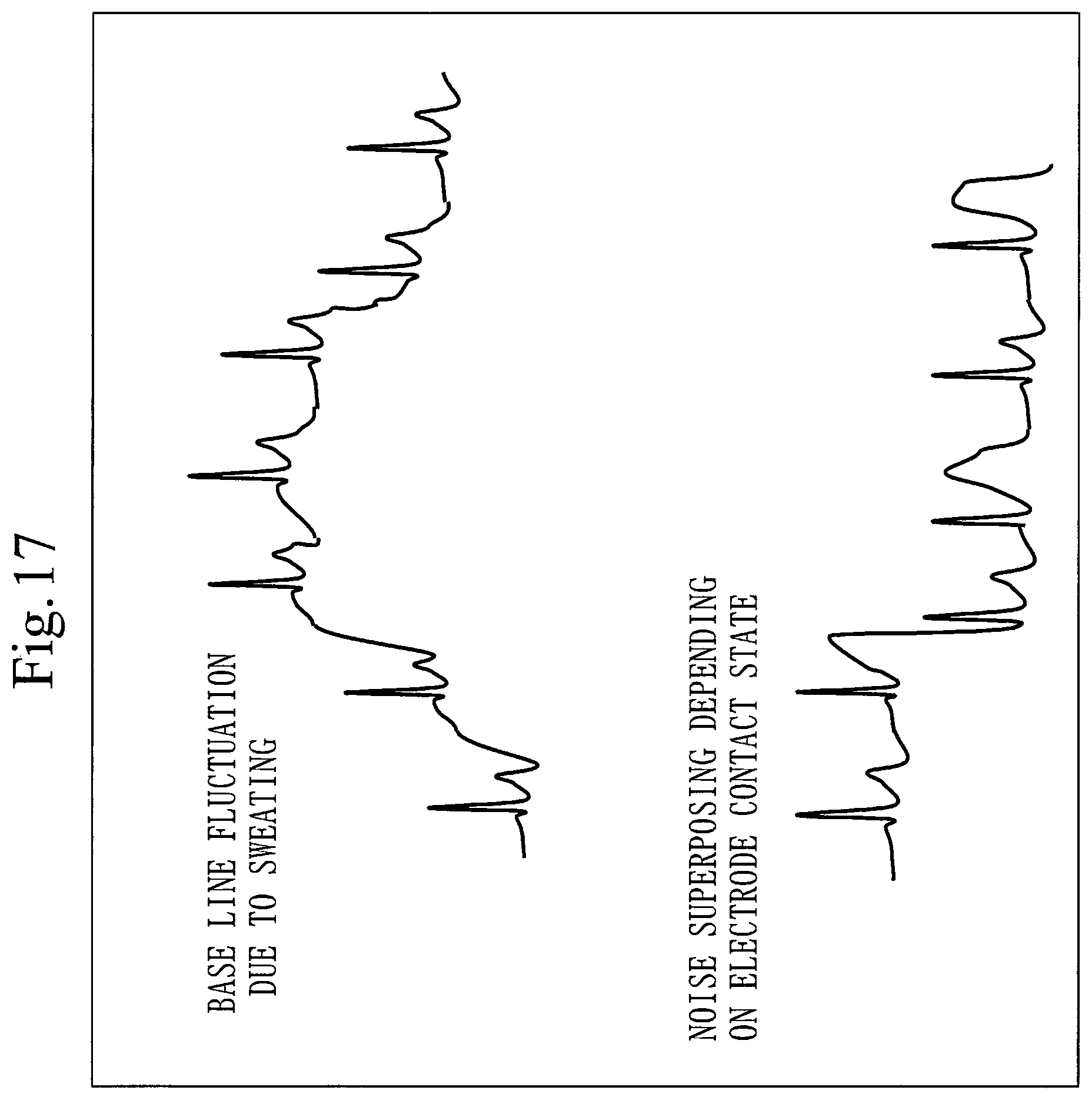 Patent US12468795 Figure 17 – Biometric authentication device, biometric authentication method, and computer readable medium