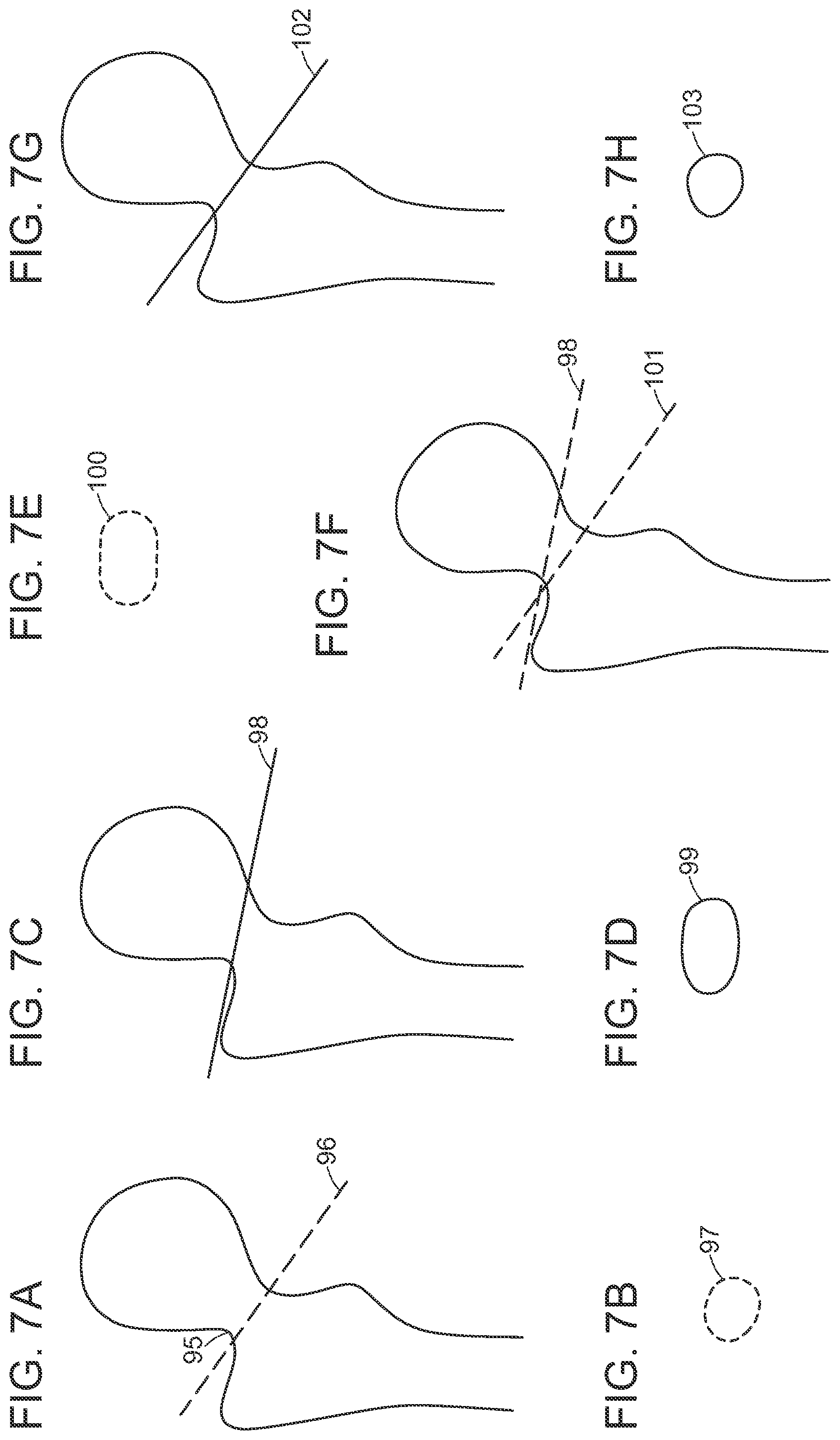 Patent US12472000 Figure 9 – Augmented reality system for monitoring size and laterality of physical implants during surgery and for billing and invoicing