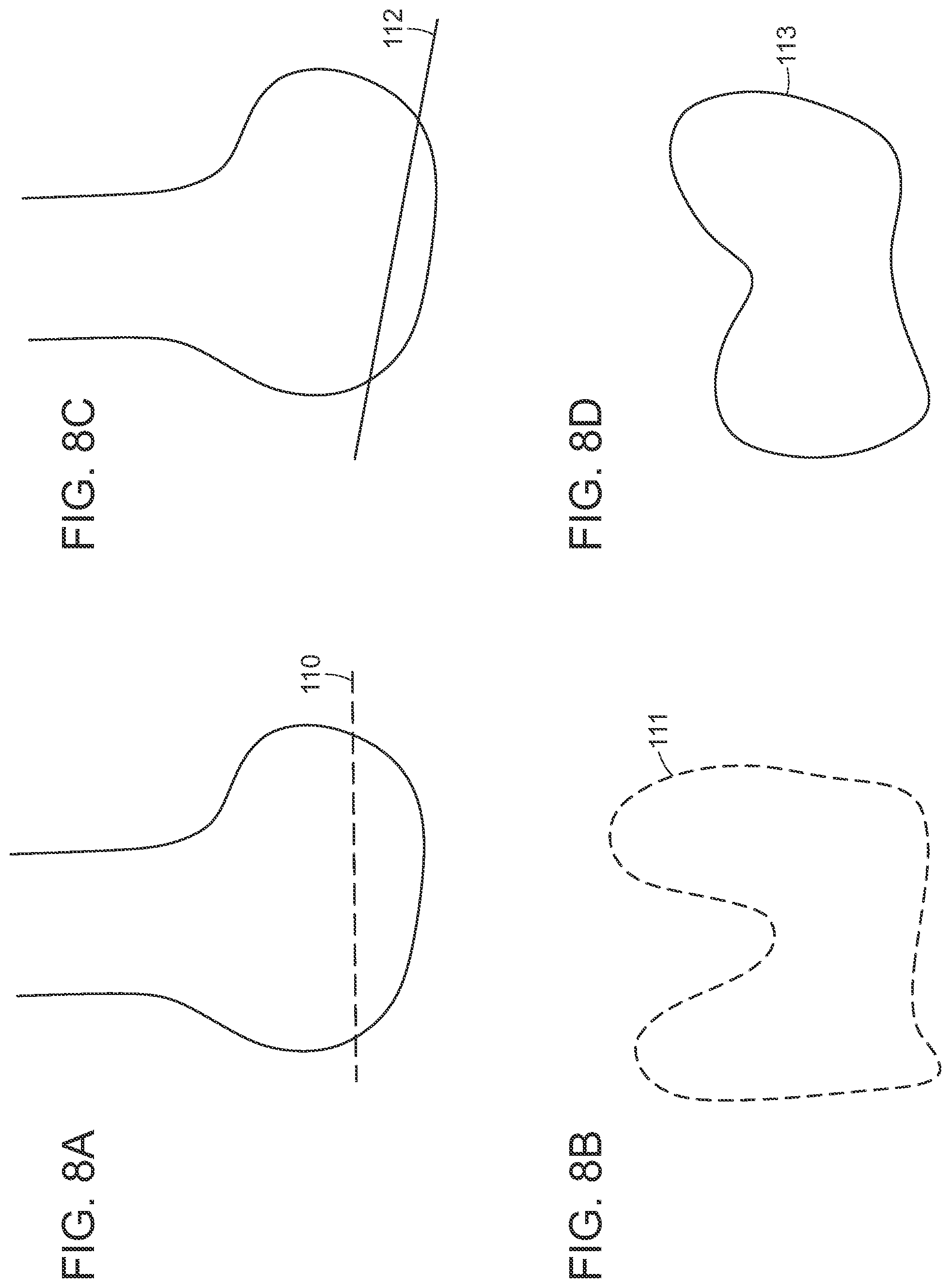 Patent US12472000 Figure 10 – Augmented reality system for monitoring size and laterality of physical implants during surgery and for billing and invoicing