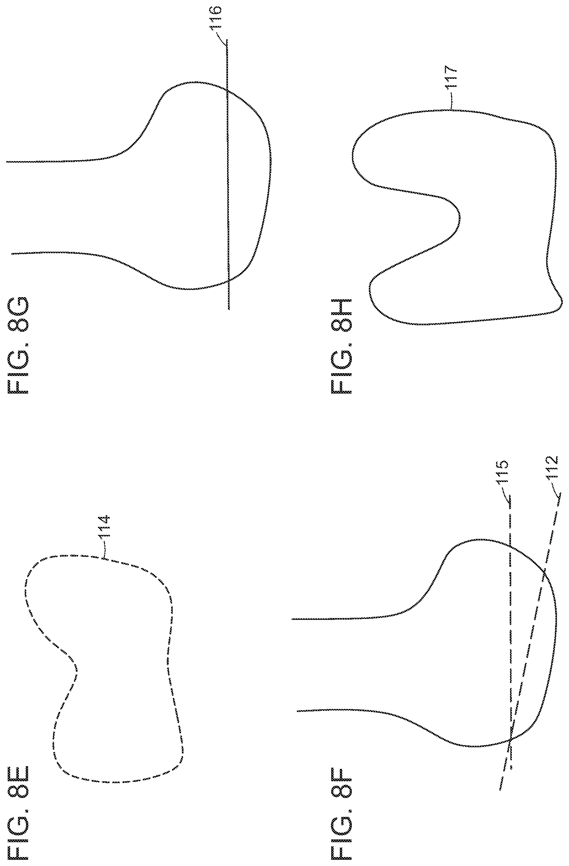 Patent US12472000 Figure 11 – Augmented reality system for monitoring size and laterality of physical implants during surgery and for billing and invoicing