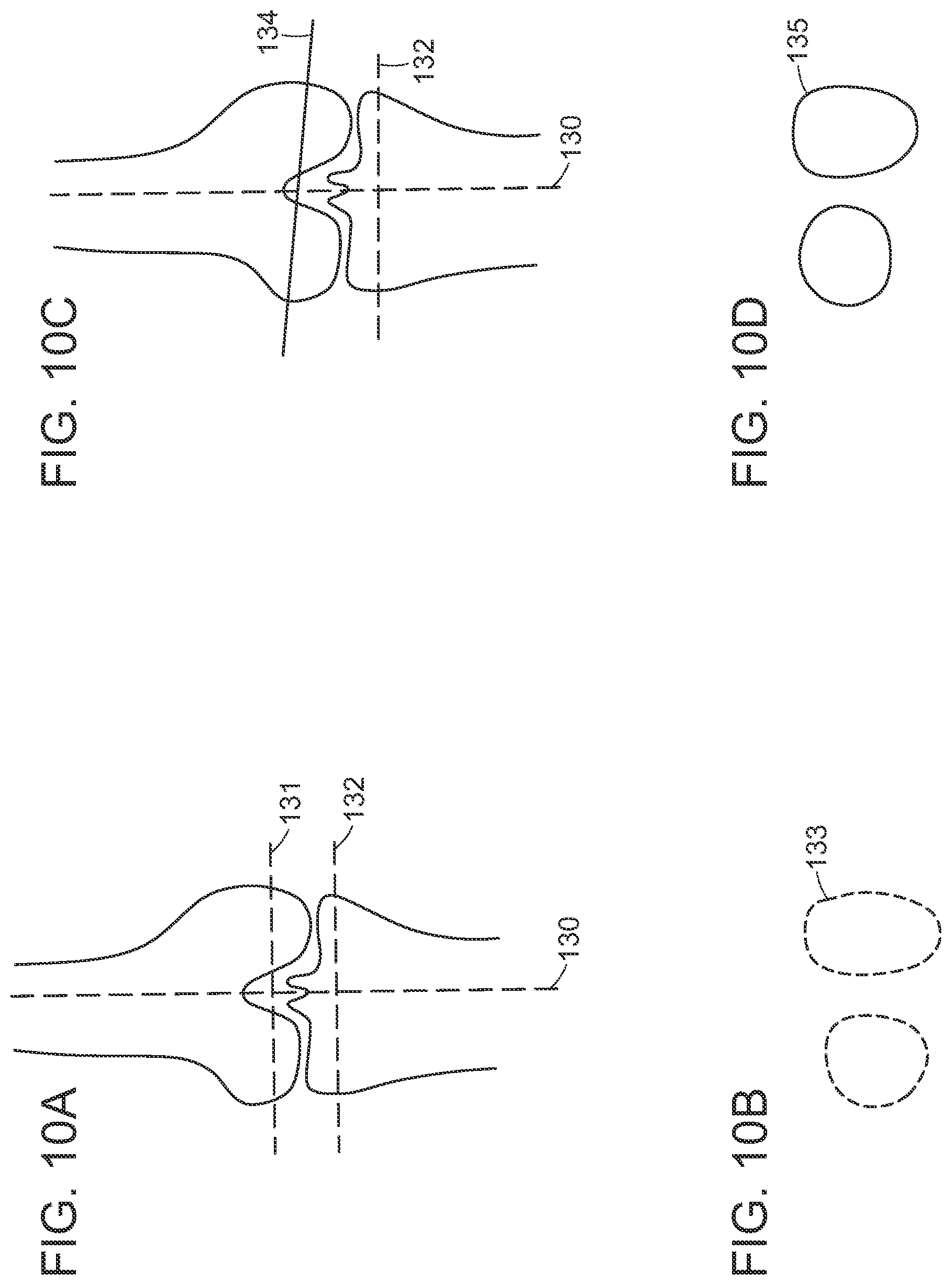 Patent US12472000 Figure 14 – Augmented reality system for monitoring size and laterality of physical implants during surgery and for billing and invoicing