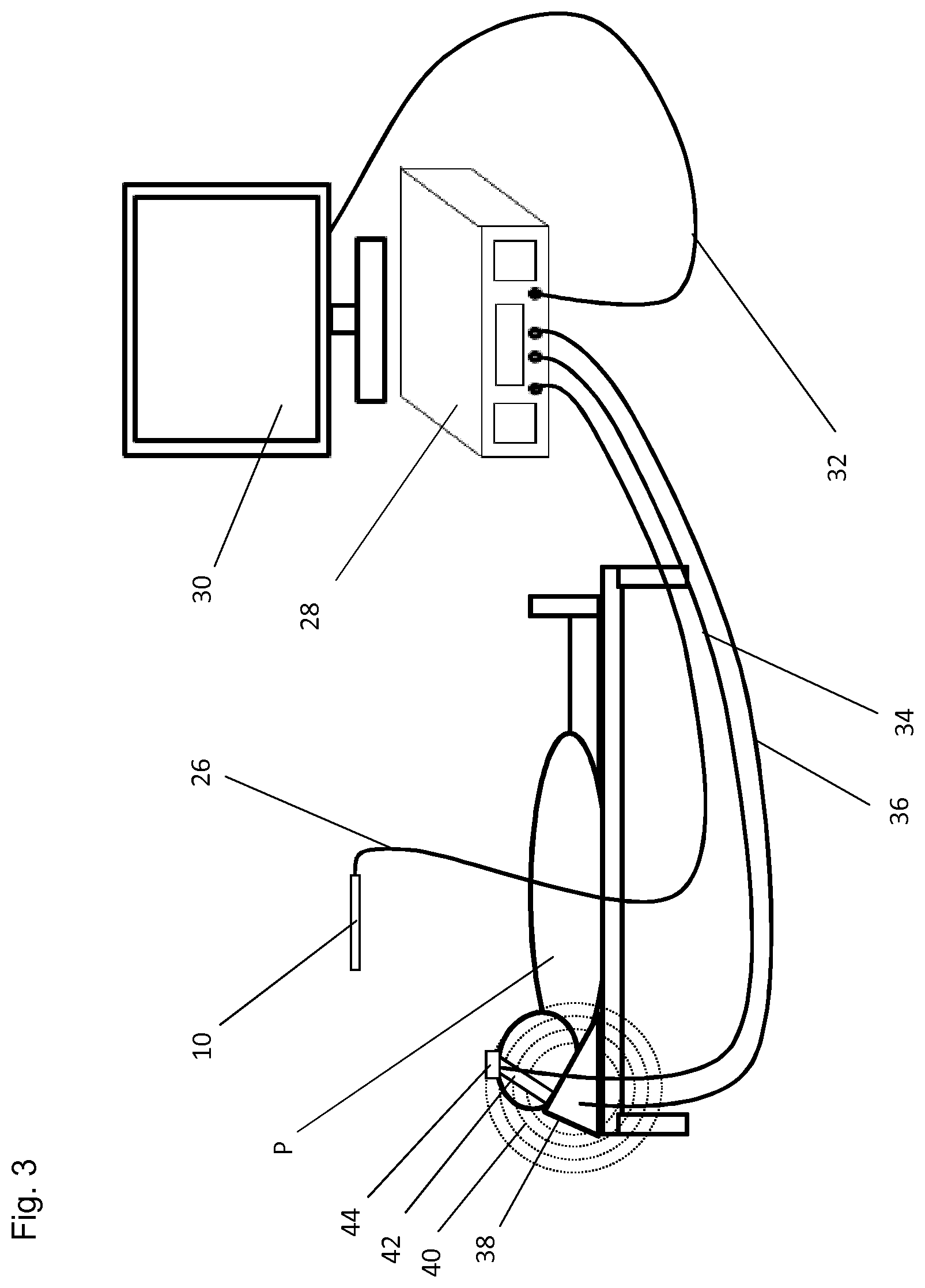Patent US12472004 Figure 3 – Surgical instrument and method for detecting the position of a surgical instrument