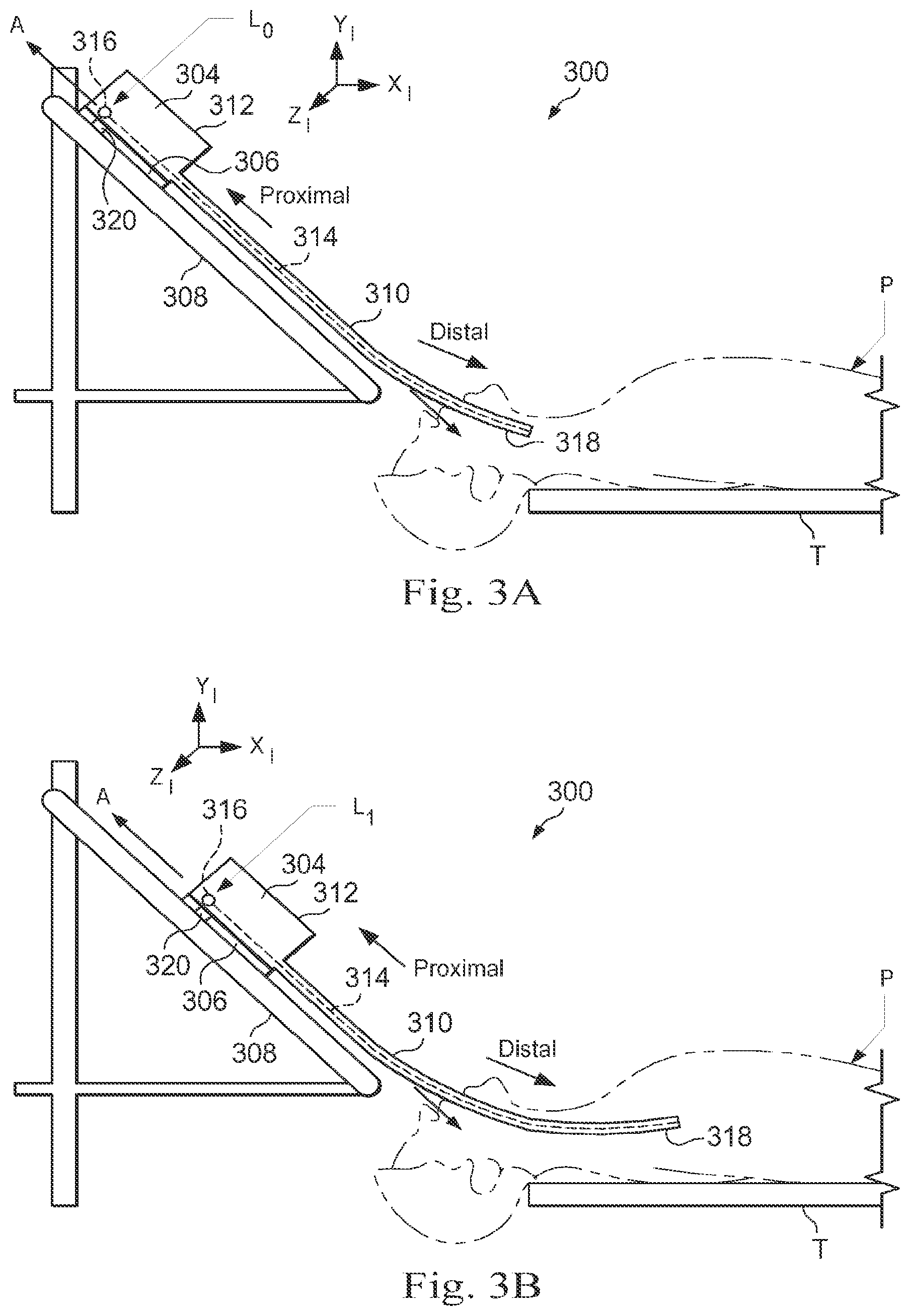 Patent US12472006 Figure 4 – Systems and methods for monitoring patient motion during a medical procedure
