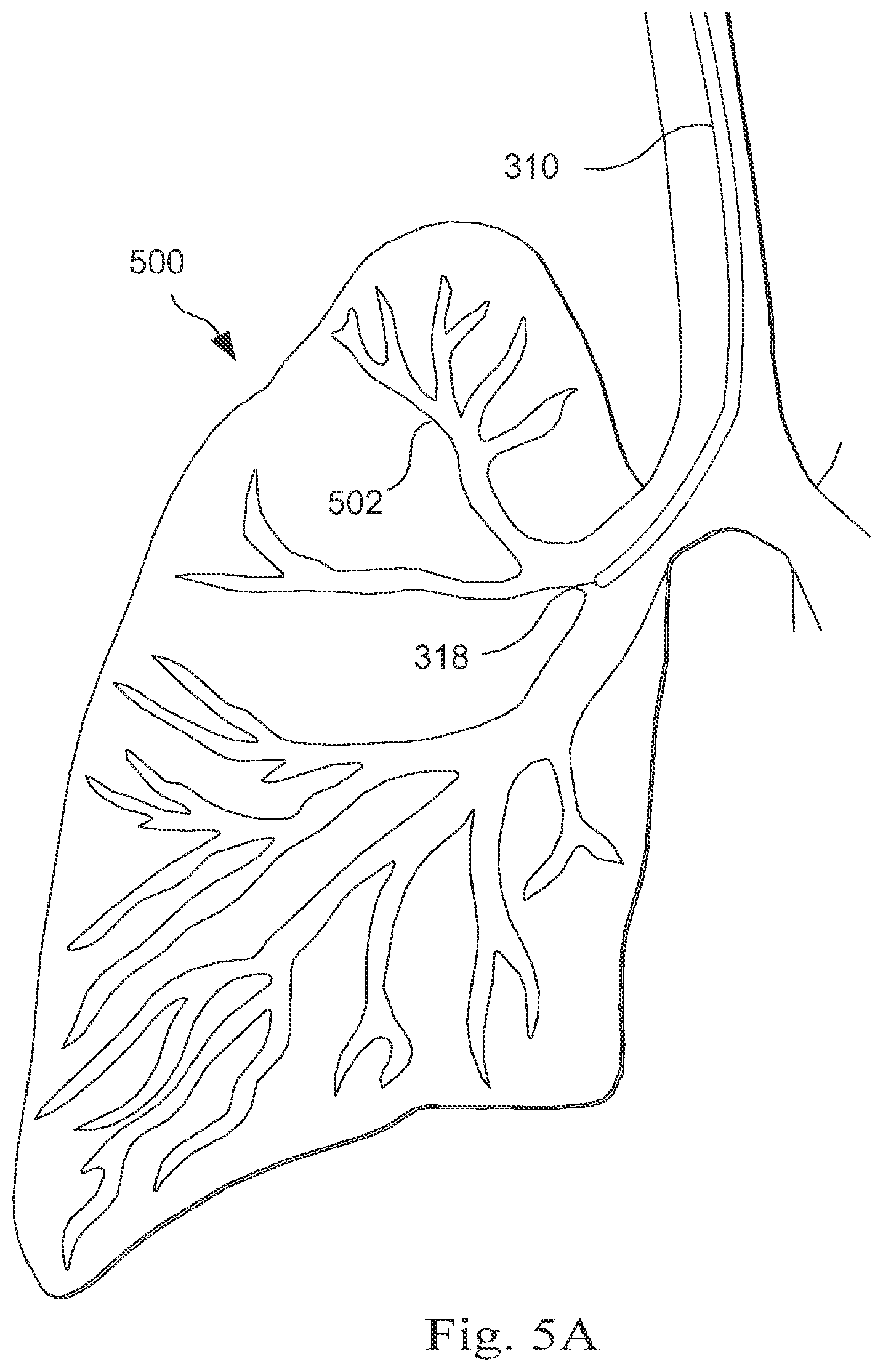 Patent US12472006 Figure 6 – Systems and methods for monitoring patient motion during a medical procedure