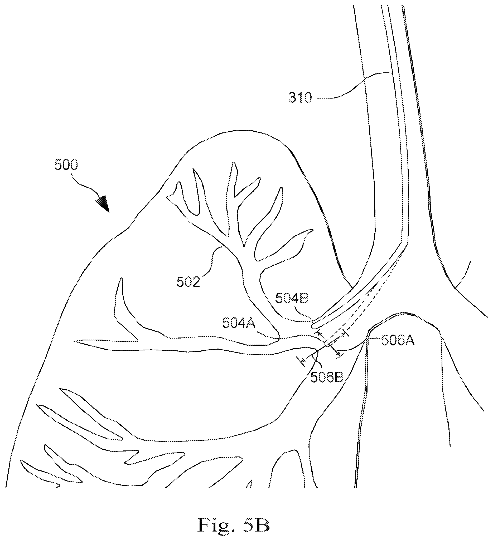 Patent US12472006 Figure 7 – Systems and methods for monitoring patient motion during a medical procedure