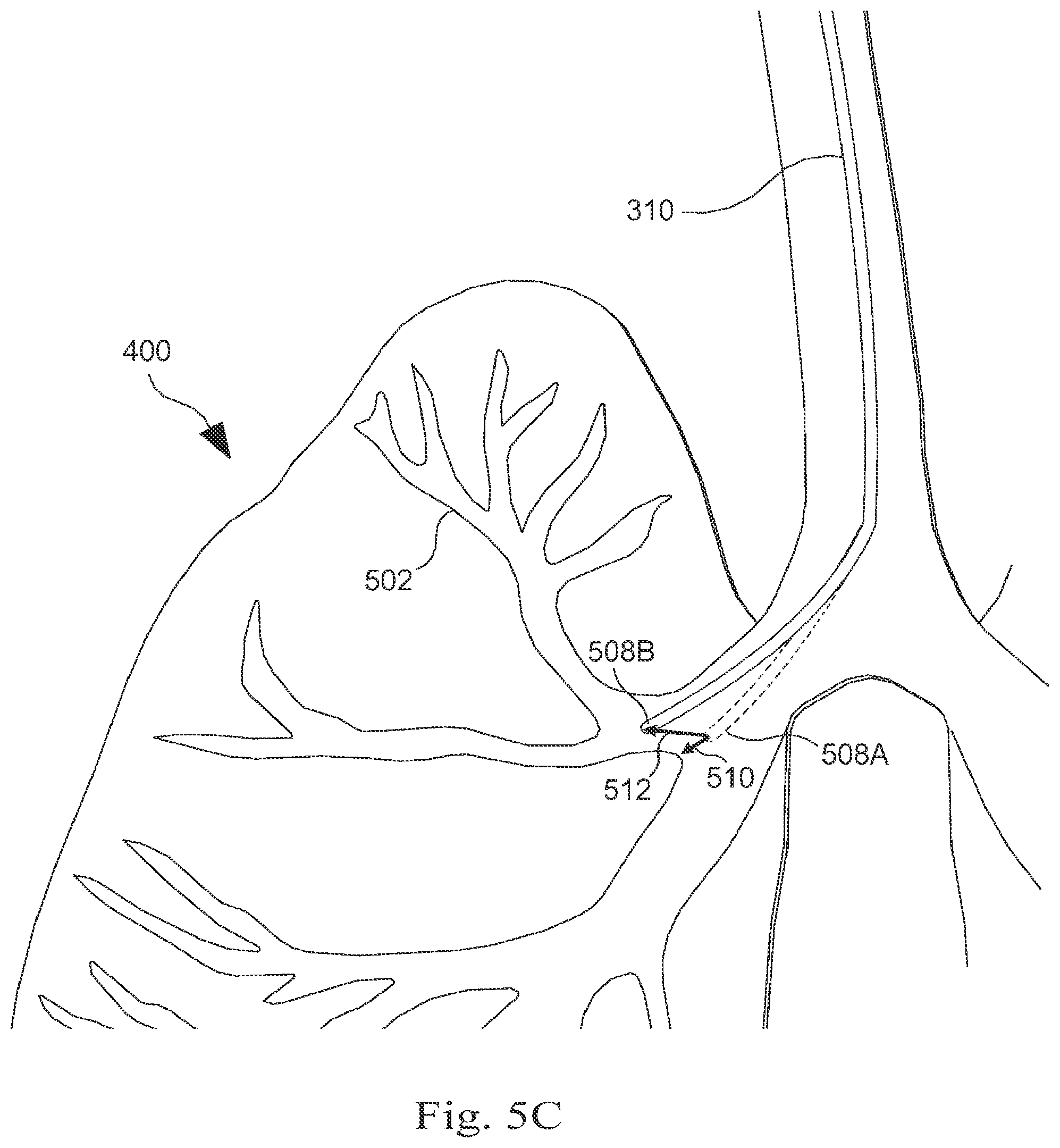 Patent US12472006 Figure 8 – Systems and methods for monitoring patient motion during a medical procedure