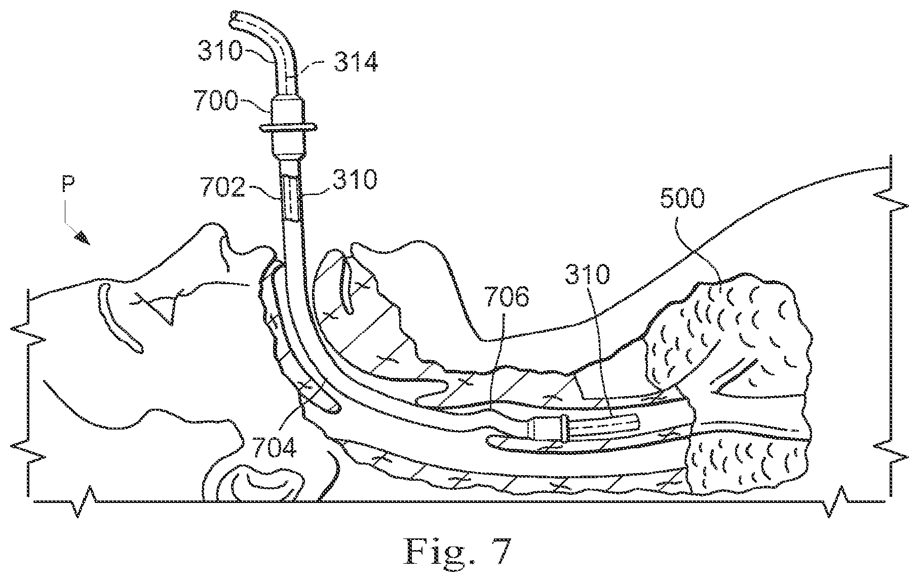 Patent US12472006 Figure 10 – Systems and methods for monitoring patient motion during a medical procedure