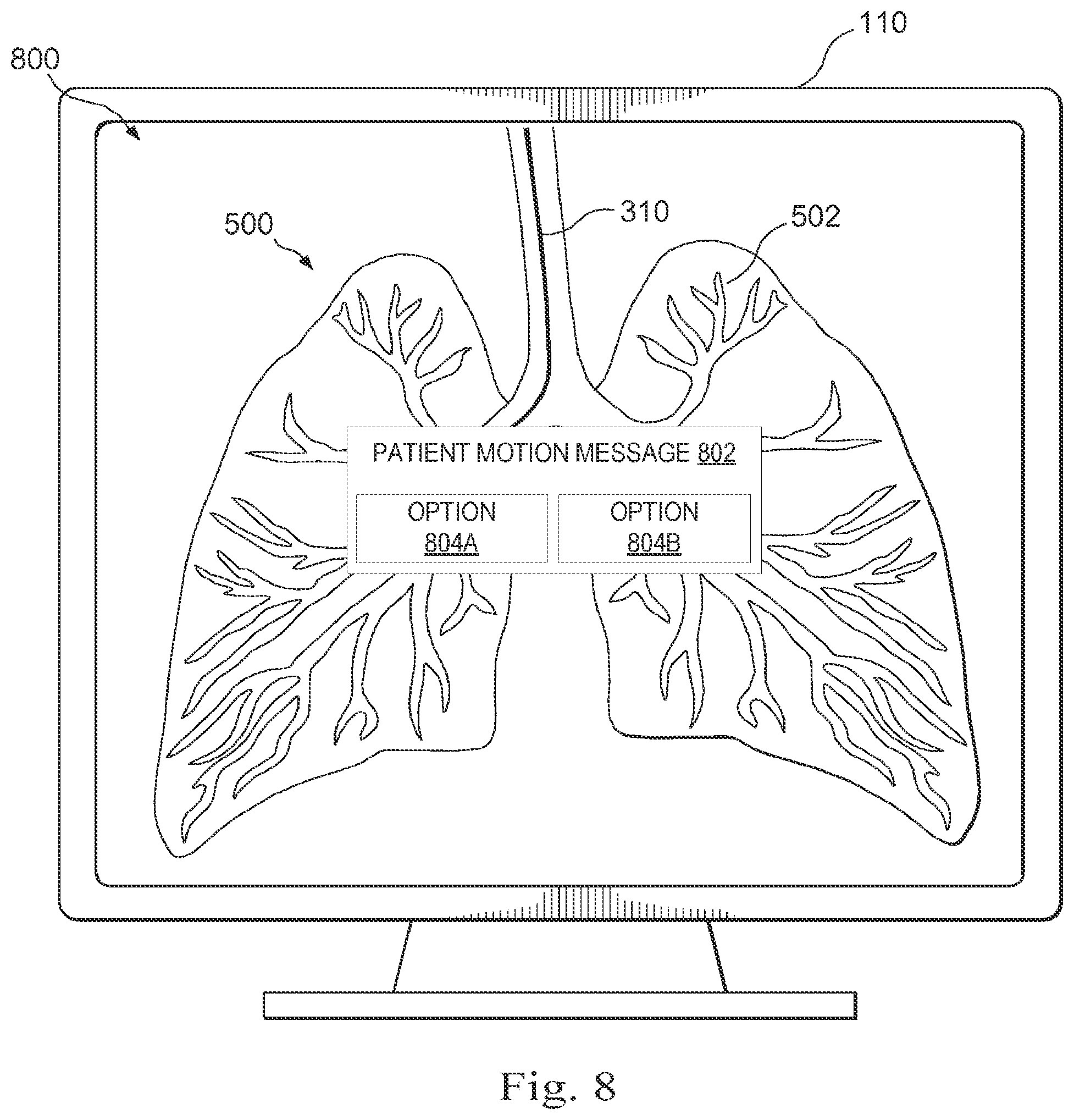 Patent US12472006 Figure 11 – Systems and methods for monitoring patient motion during a medical procedure
