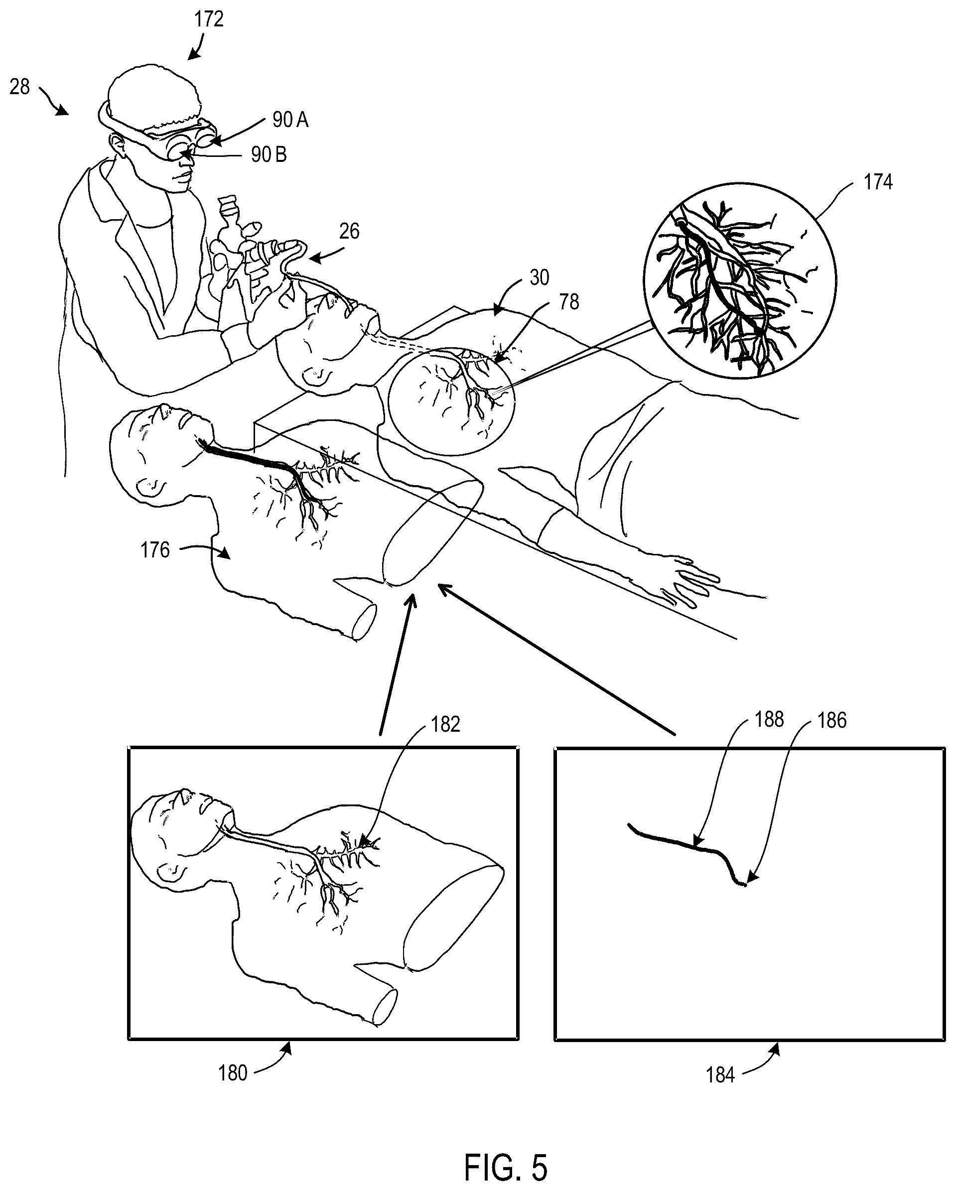 Patent US12472007 Figure 5 – Viewing system for use in a surgical environment